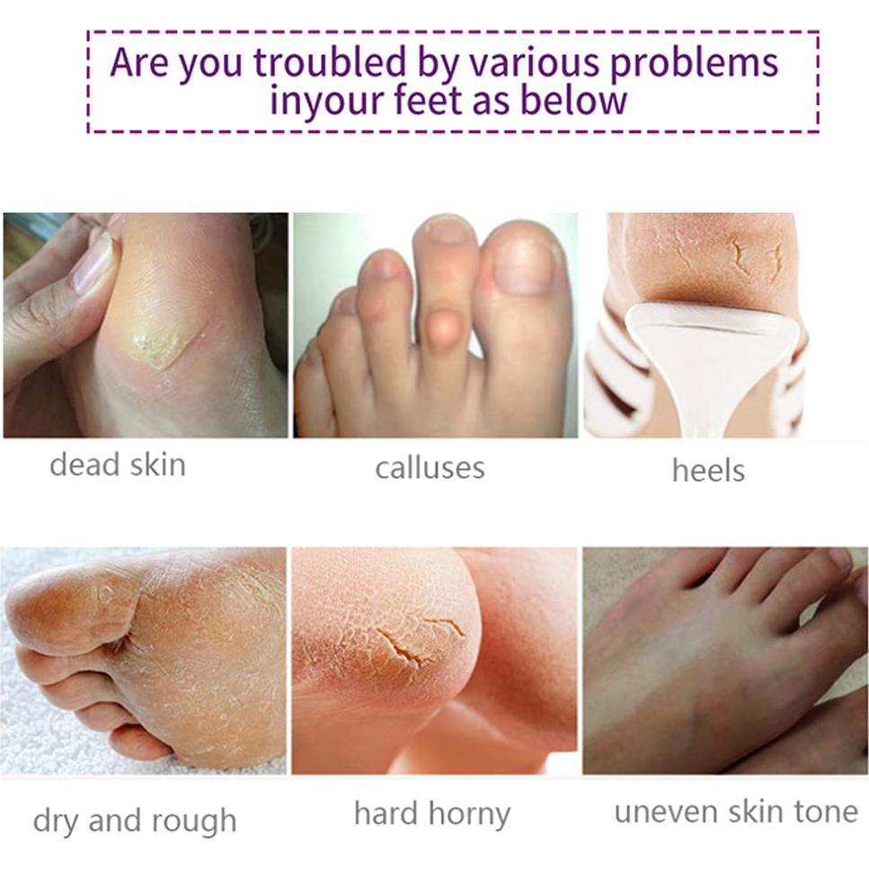 Mascarilla Exfoliante para Pies AIQIUSHA 5 Paquetes Lavanda