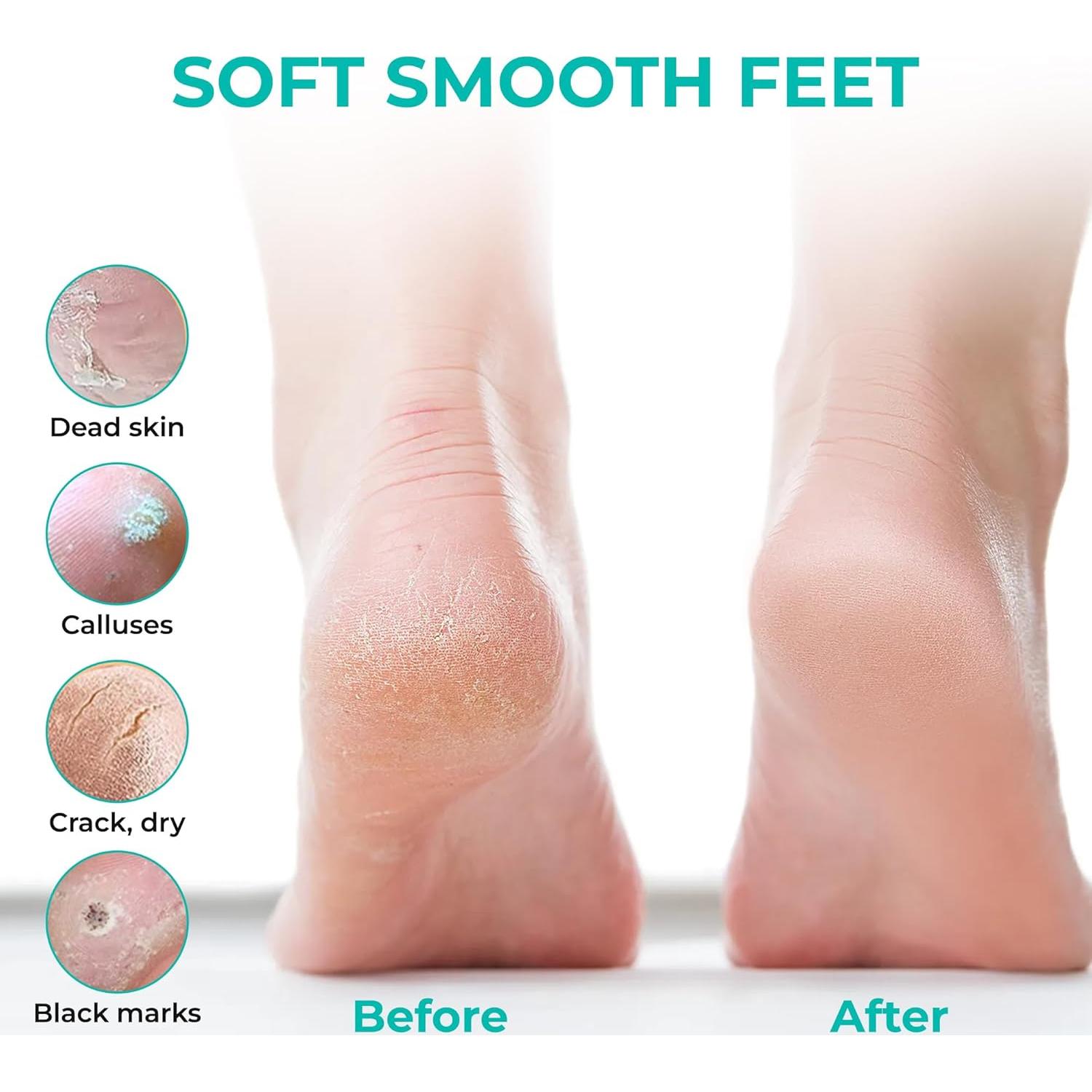 Máscara Exfoliante para Pies Happy Feet - 3 Paquetes, Limón