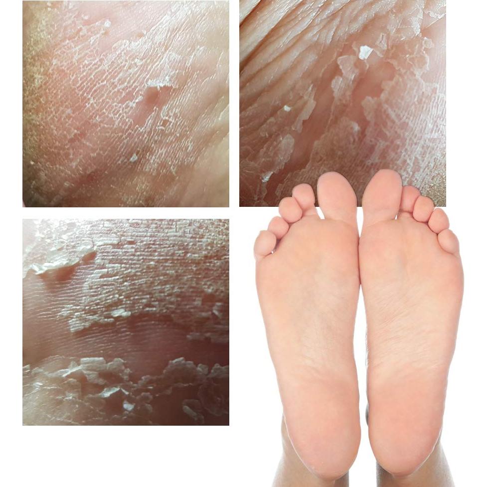 Mascarilla Exfoliante para Pies Elizavecca - 2 Pares 40g