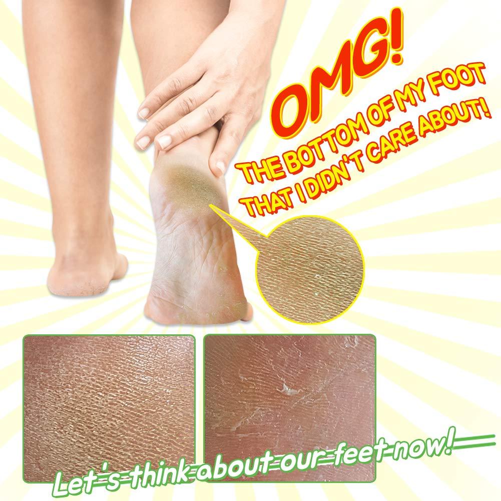 Mascarilla Exfoliante para Pies Elizavecca - 2 Pares 40g