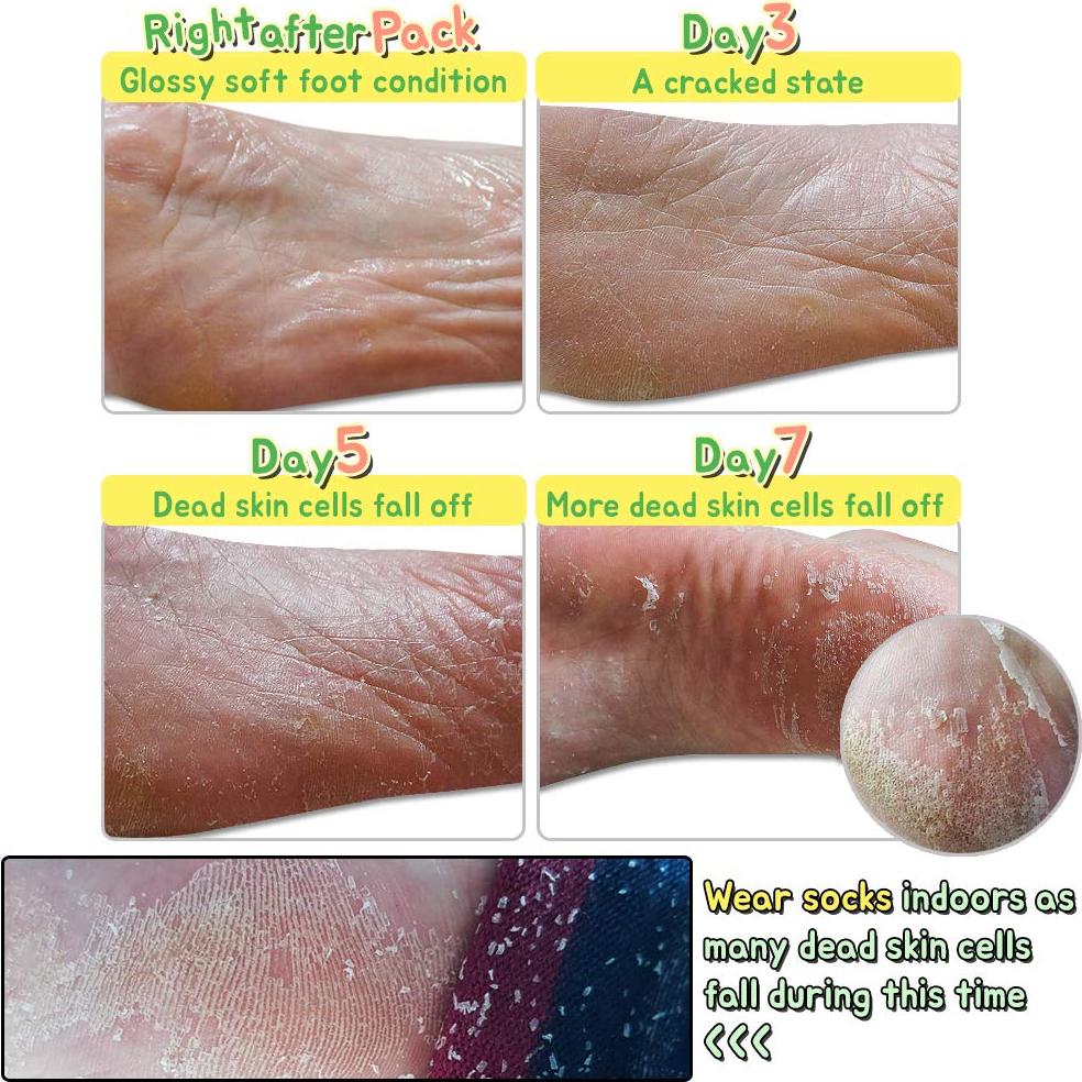 Mascarilla Exfoliante para Pies Elizavecca - 2 Pares 40g