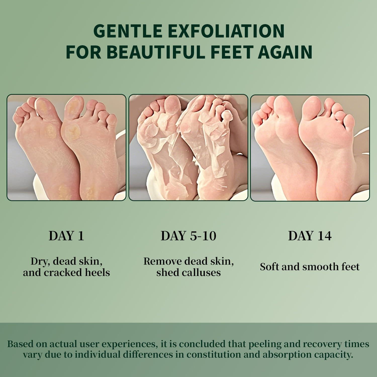 Mascarilla Exfoliante para Pies Danliss - 3 Paquetes con Urea y Aloe Vera