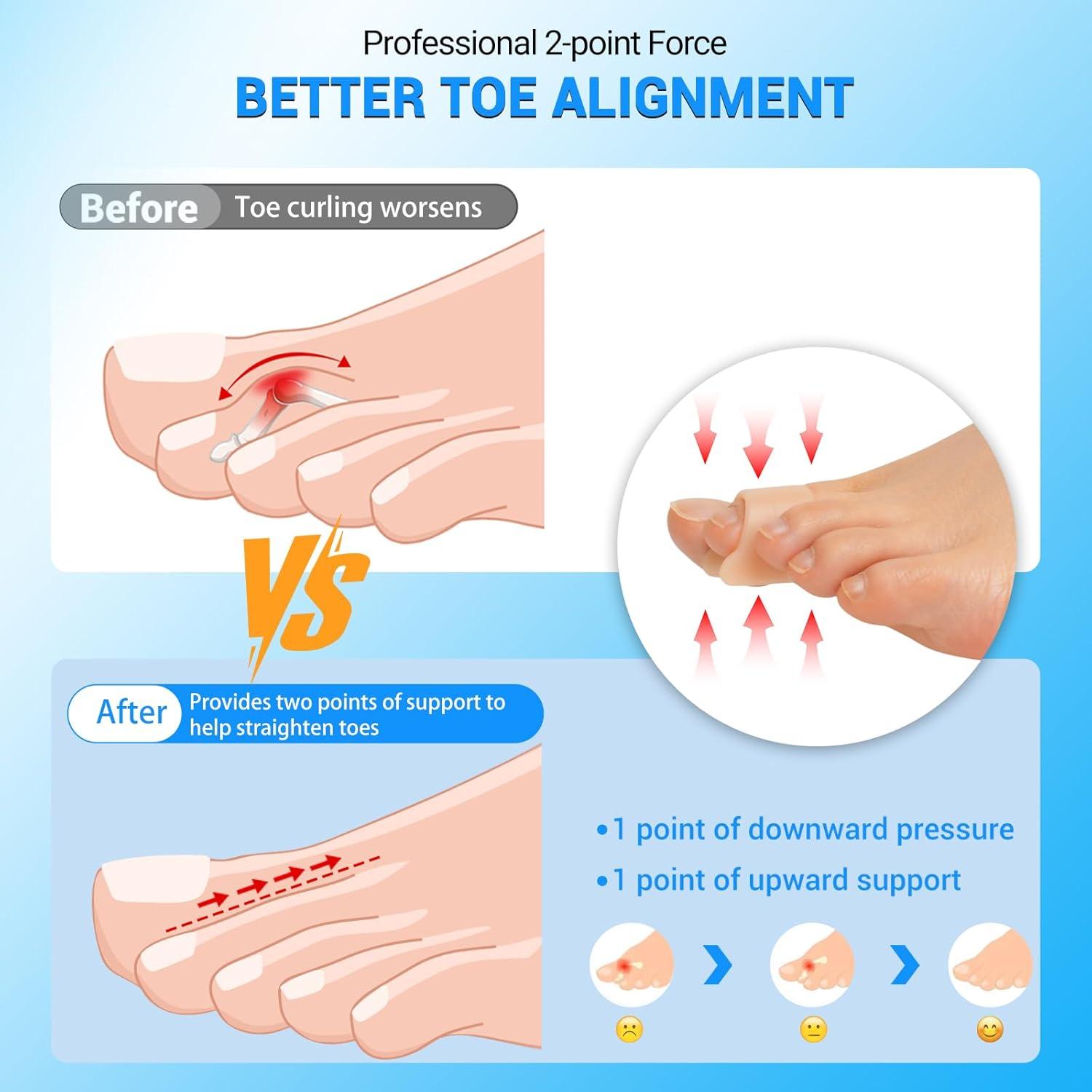 Hammer Toe Straightener Corrector for women & men- 6 Pcs Gel Toe Splint Relief for Bunion, Claw, Crooked, Hammer, Broke Support - 3 Different Sizes (S/M/L)