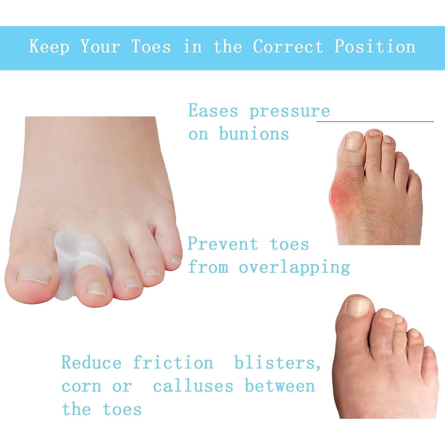 Separadores de Gel para Dedos de los Pies MENOCADY - 12 Piezas