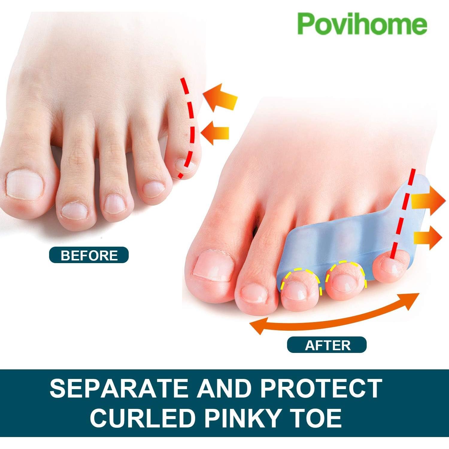 Separadores de Dedo Meñique Povihome 10 Piezas Alivio Dolor