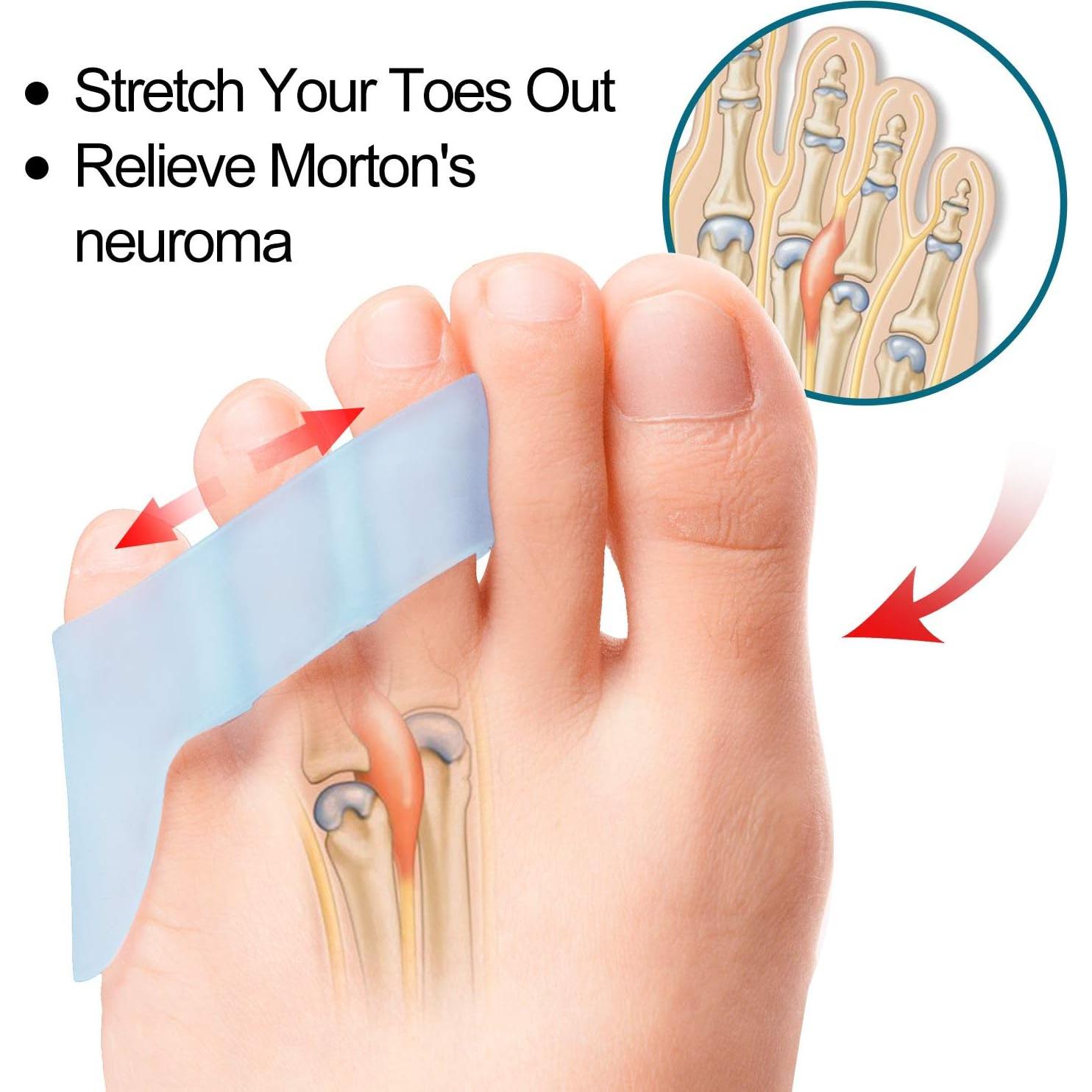 Separadores de Dedo Meñique Povihome 10 Piezas Alivio Dolor