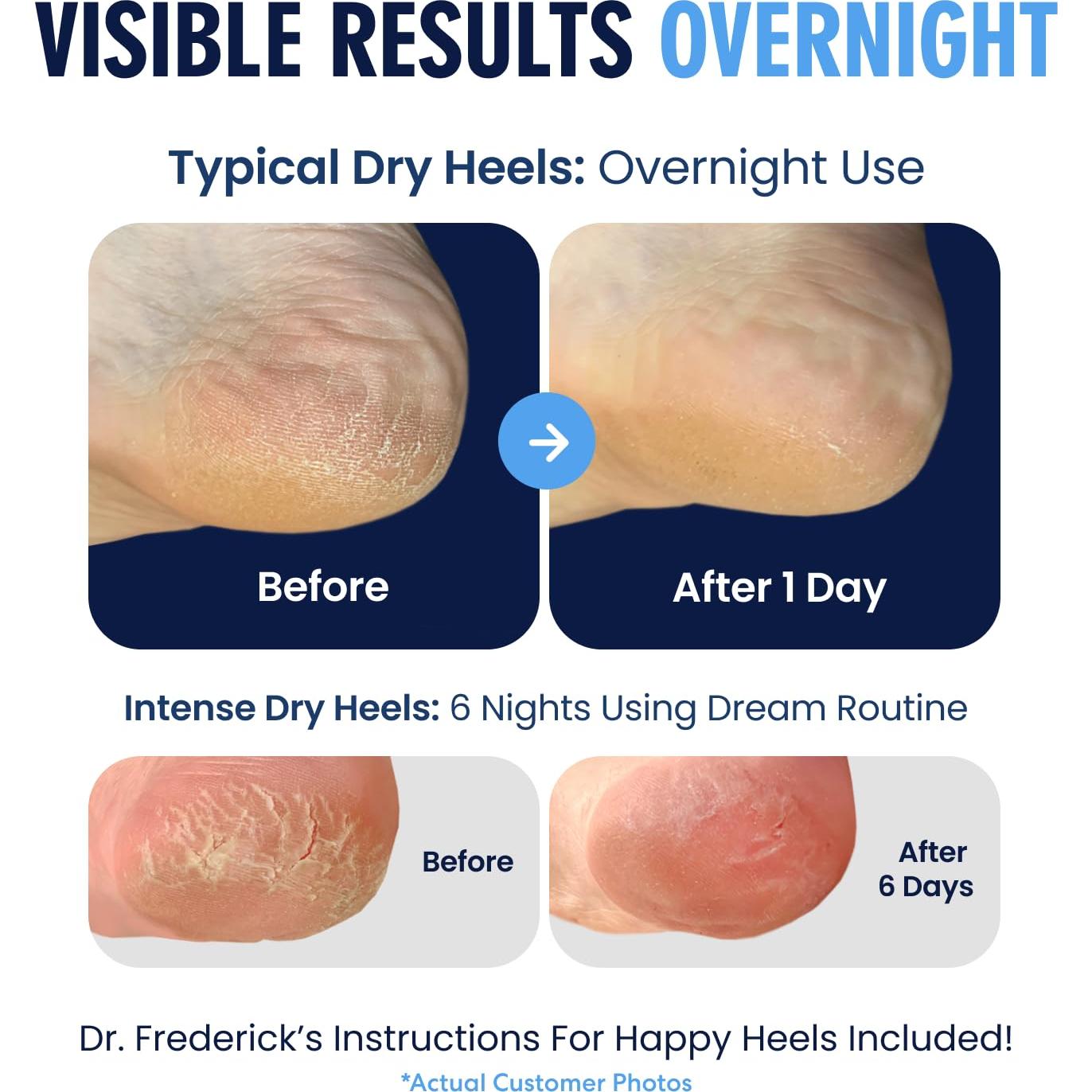 Calcetines Hidratantes para Talones Dr. Frederick - 2 Pares