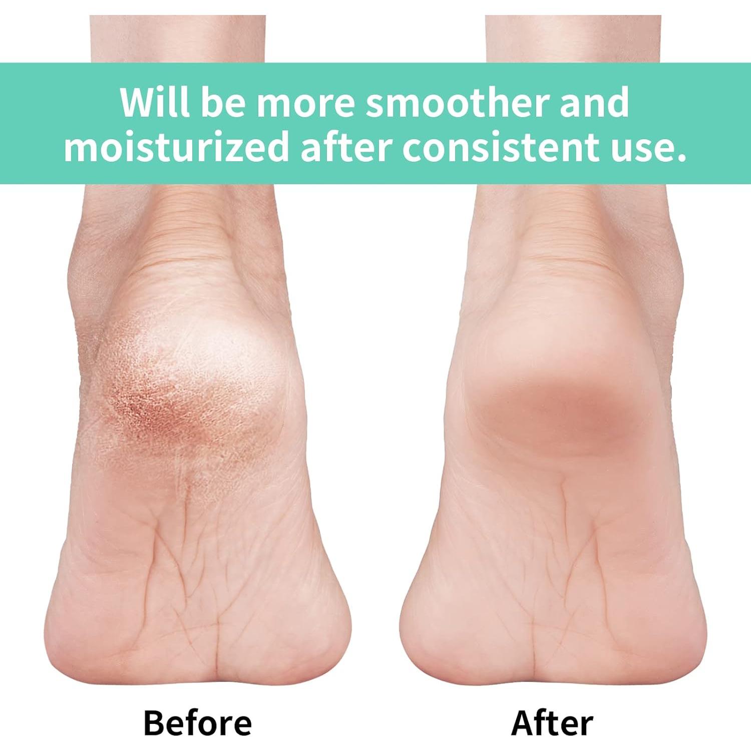 Calcetines Hidratantes Vaincre para Talones Agrietados - 4 Pares