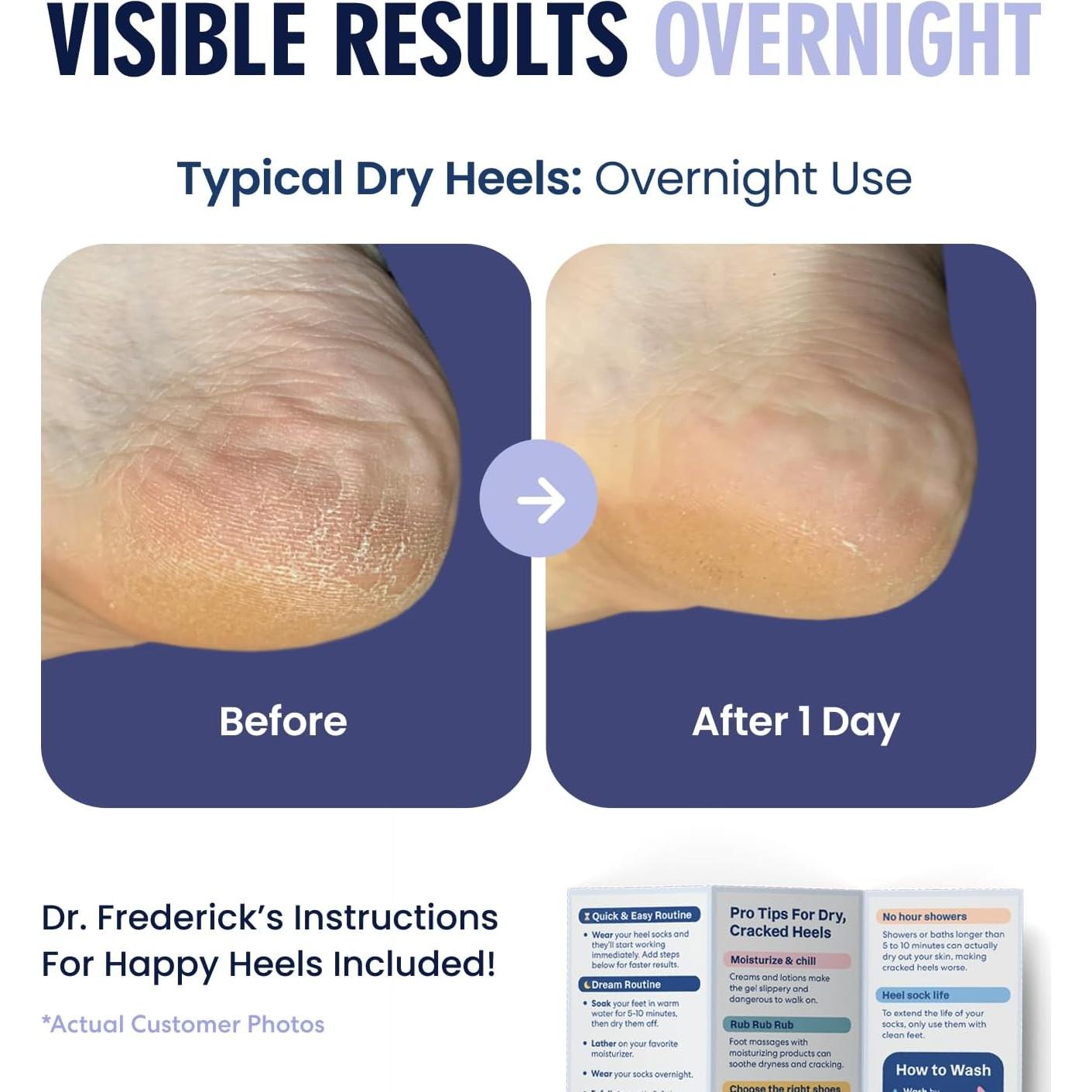 Calcetines Hidratantes Dr. Frederick - 2 Pares - Talón Difuso