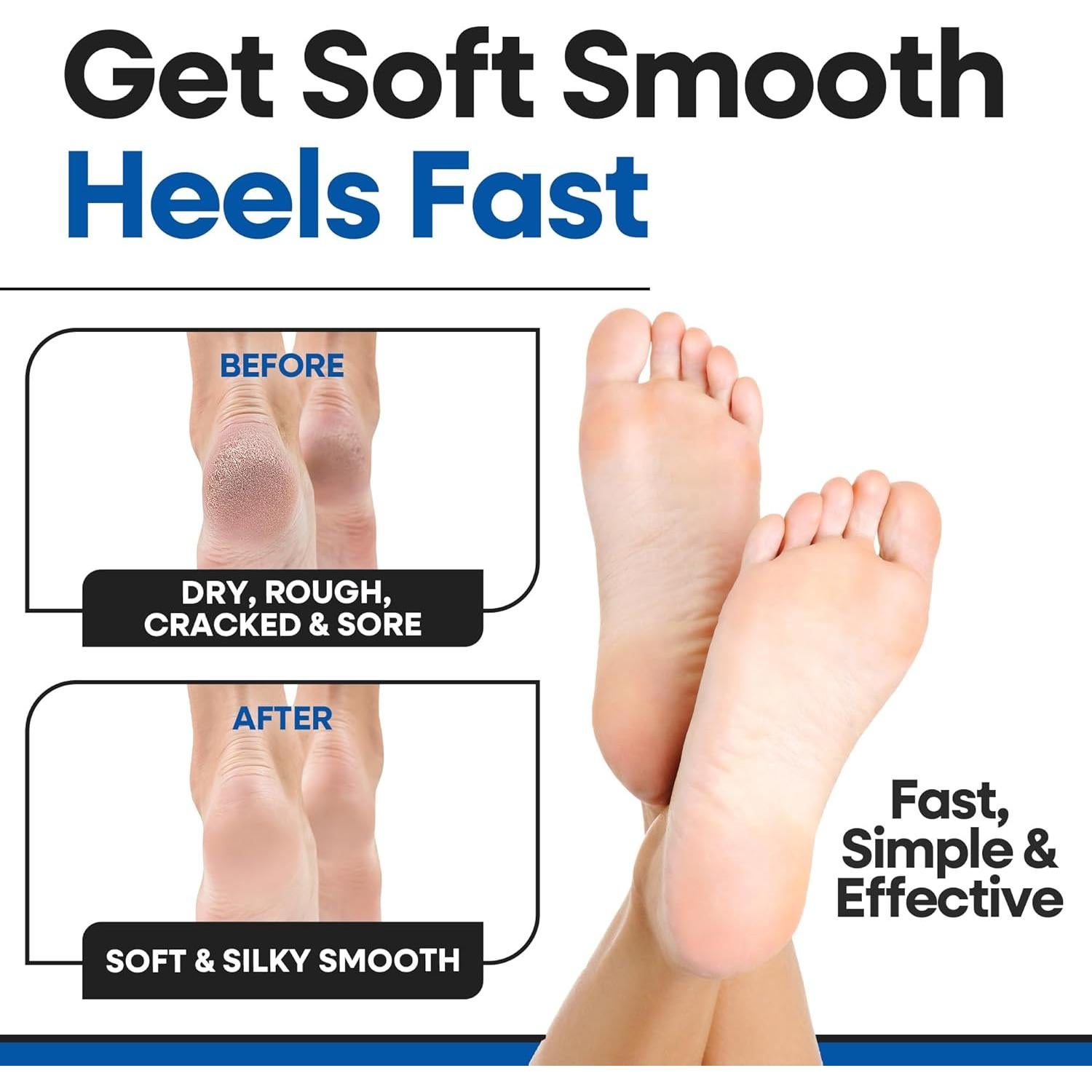 Calcetines Hidratantes Aloe Vera para Talones Agrietados - 3 Pares