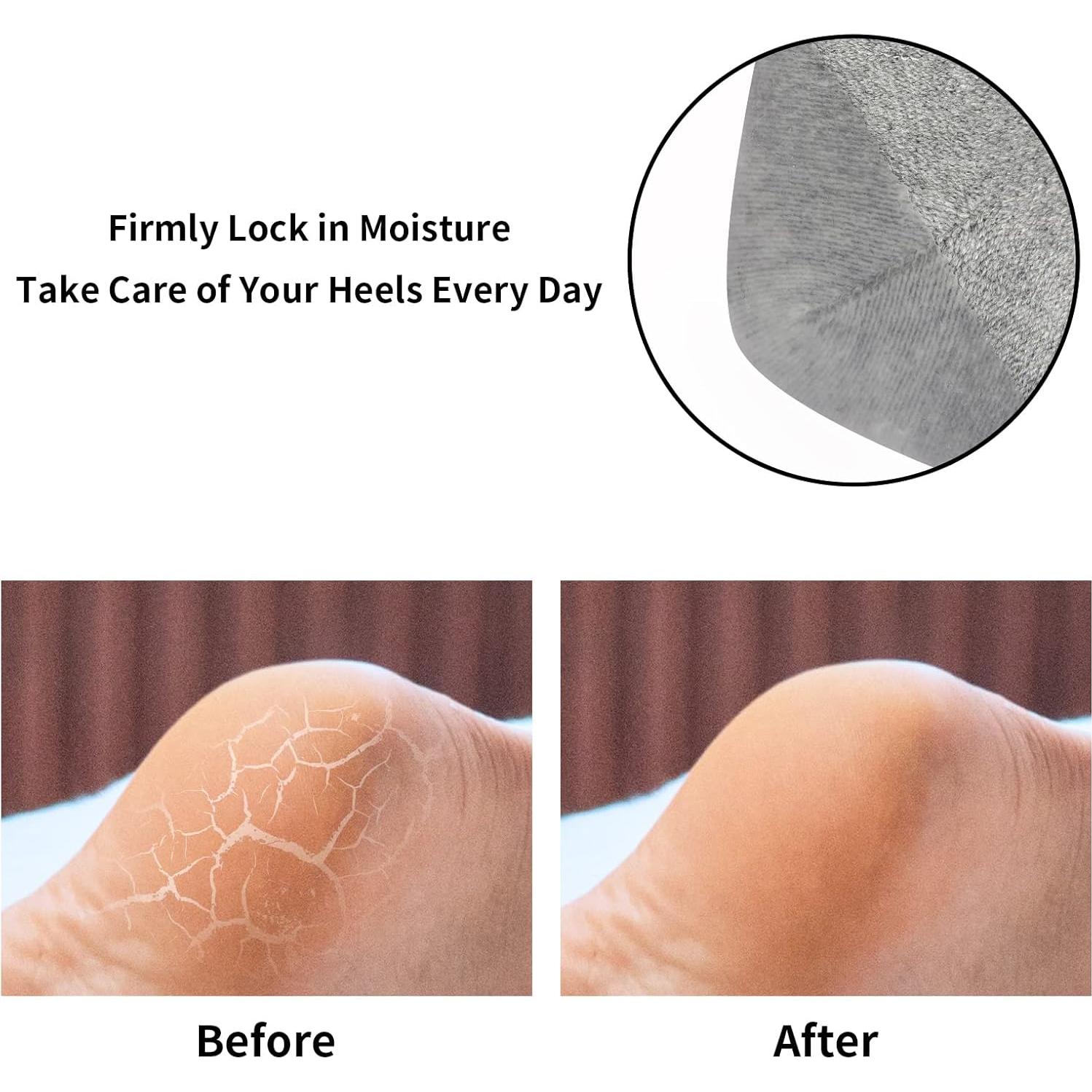 Calcetines Hidratantes Tifanso 3 Pares para Talones Agrietados