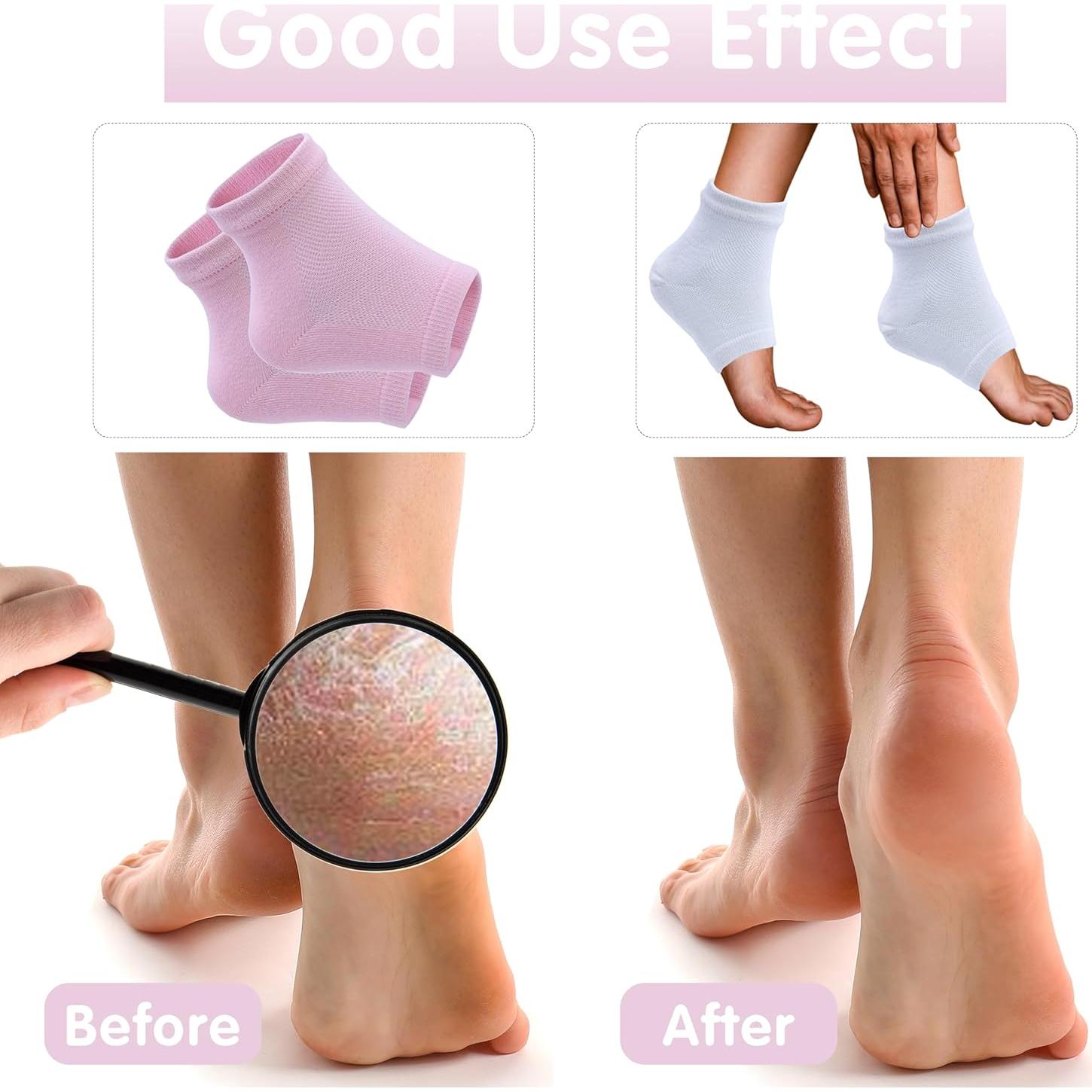 Calcetines Hidratantes para Talones Secos y Agrietados - 2 Pares