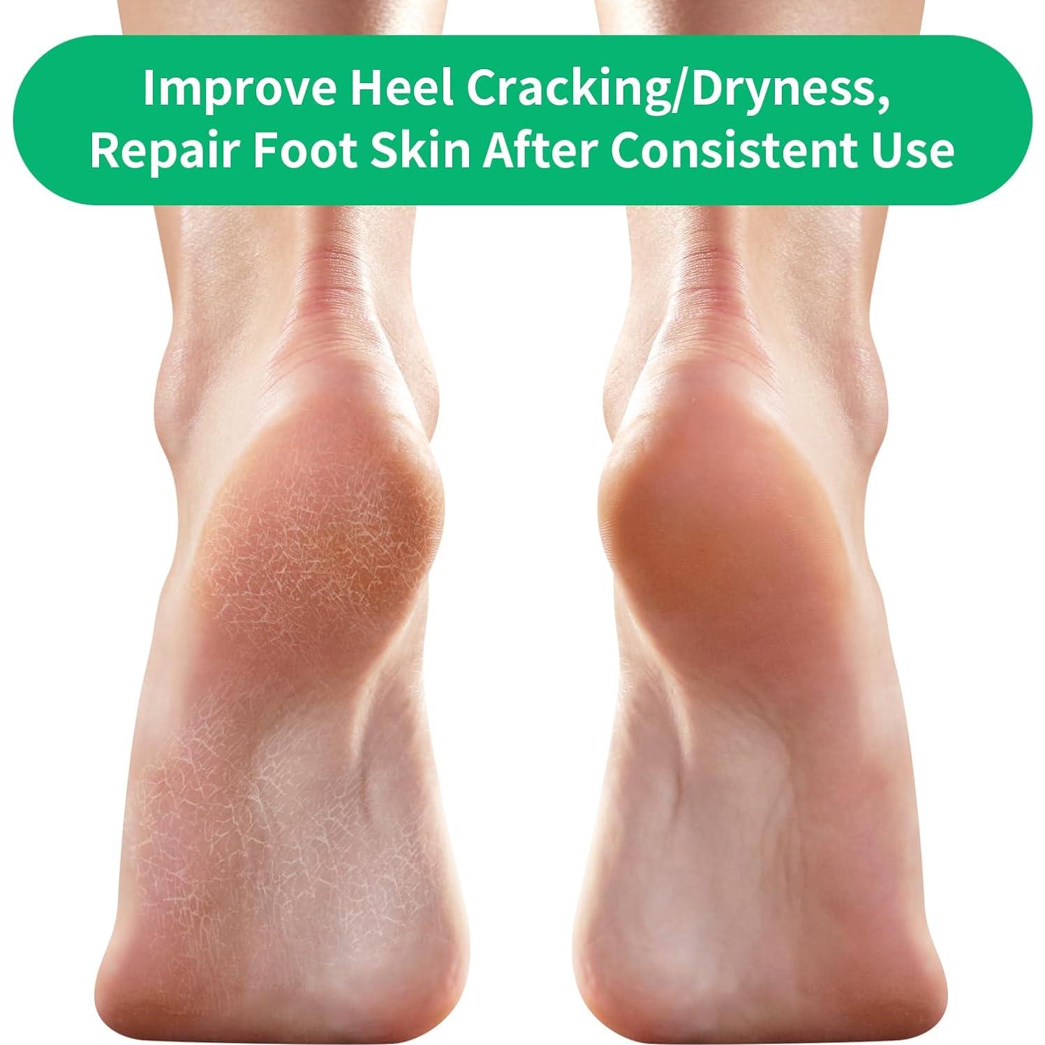 Calcetines Hidratantes Ohtomber para Talones Agrietados - 5 Pares