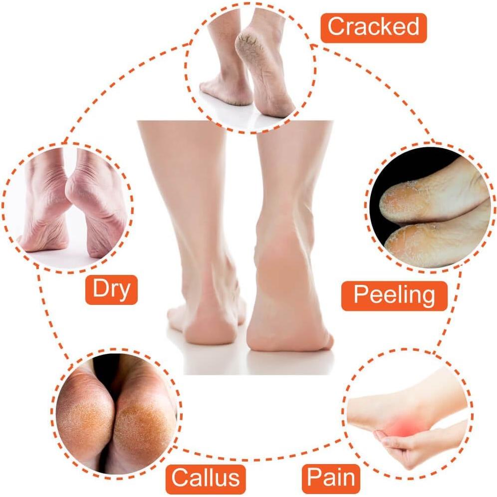 Calcetines Hidratantes Selizo 5 Pares para Talones Secos