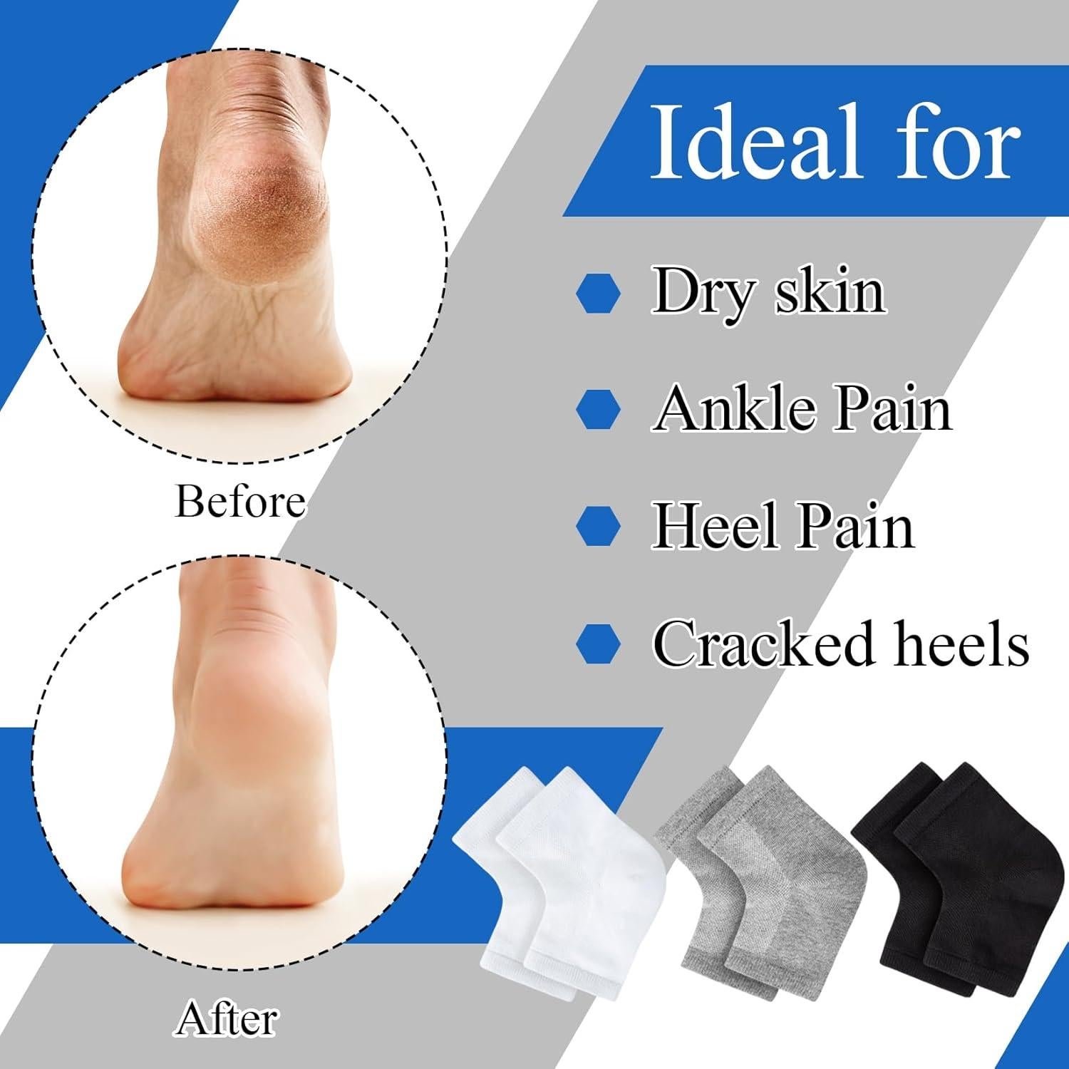 Calcetines Hidratantes Unoutur - 12 Pares Sin Dedos para Pies