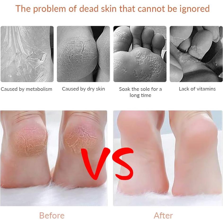 Raspador de Piel Dura para Pies Codream con Estuche y 10 Cuchillas