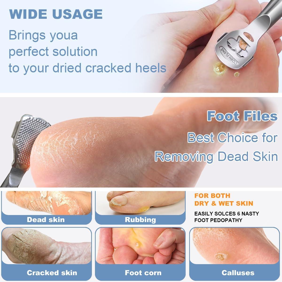 Set de Raspadores de Callos POQOD - 36 Piezas, Acero Inoxidable