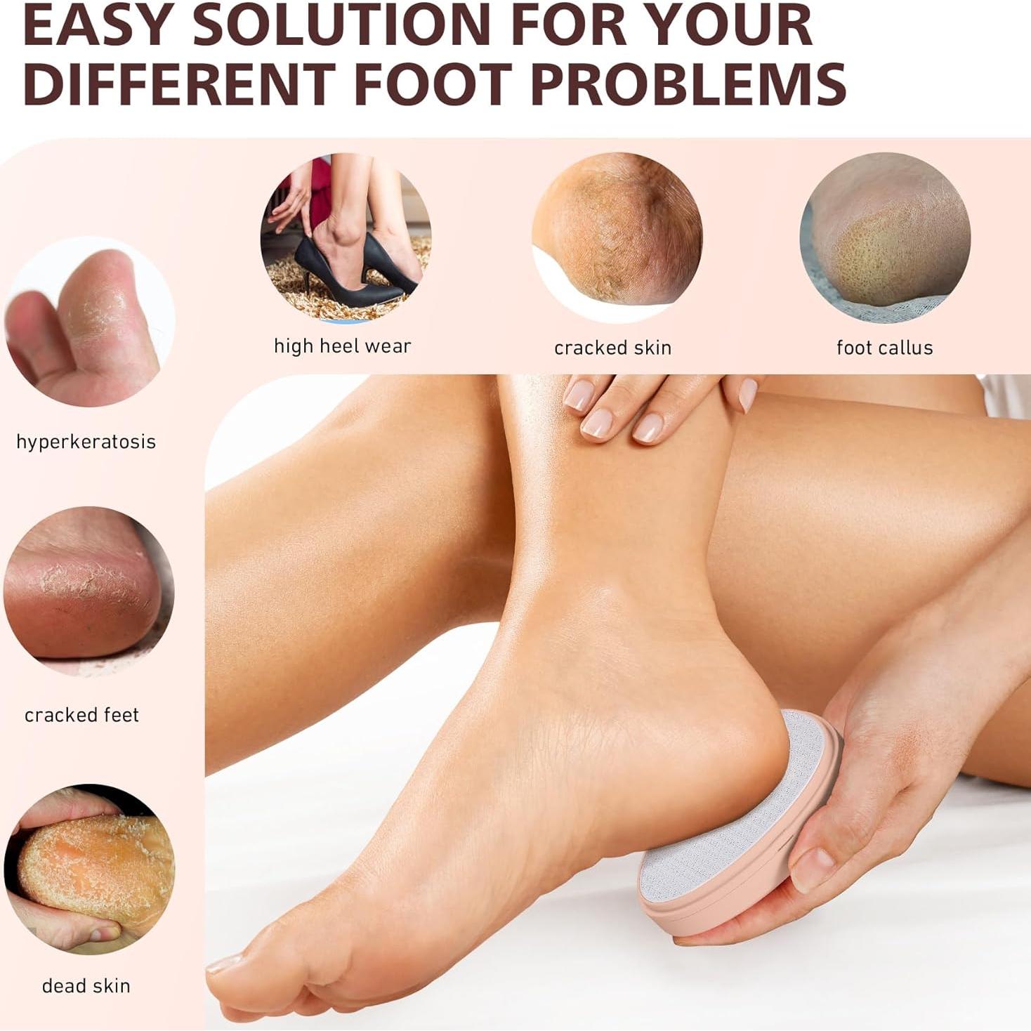 Lima de Pies de Vidrio Nano BALUCA - Removedor de Callos