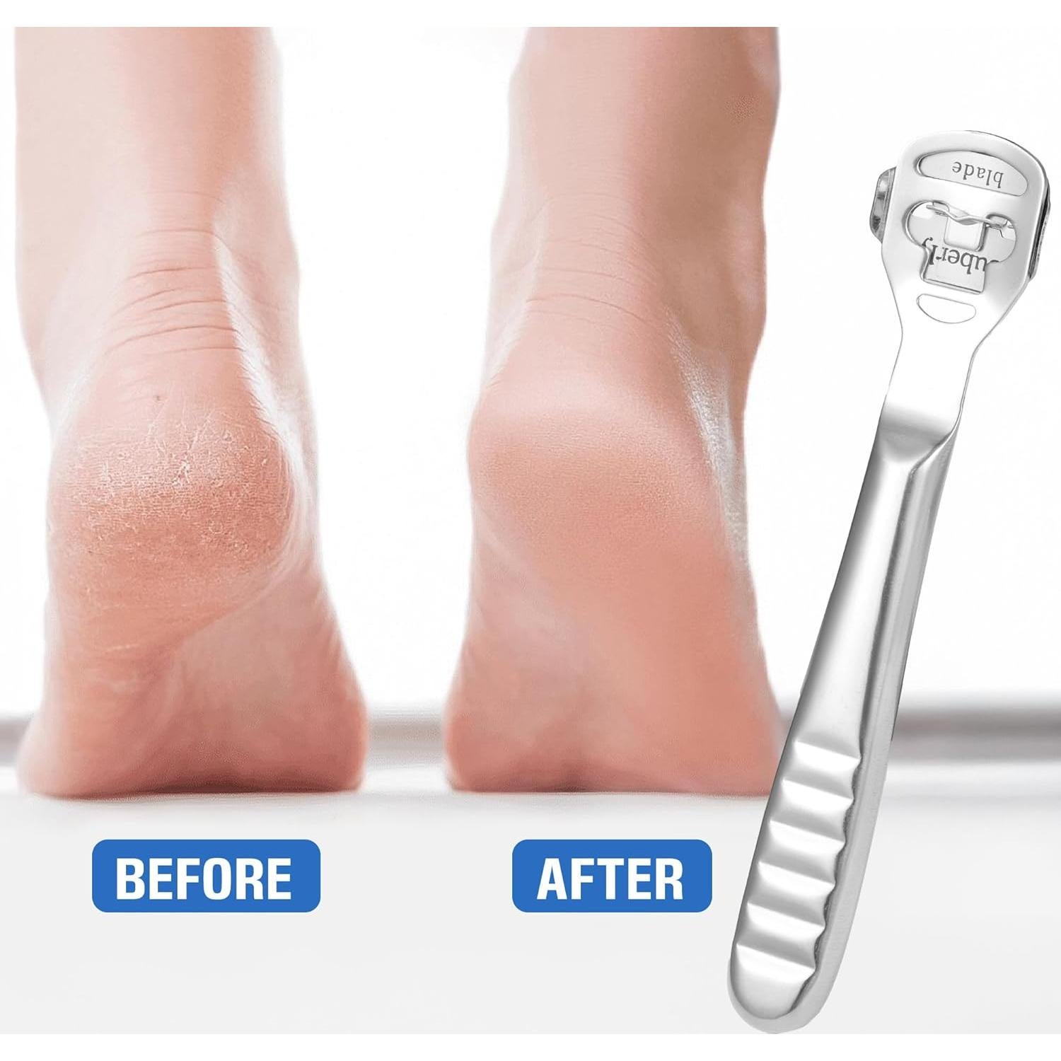 Kit de Raspador de Callos MIUKAA con 10 Cuchillas - Herramienta Profesional para Pies y Manos