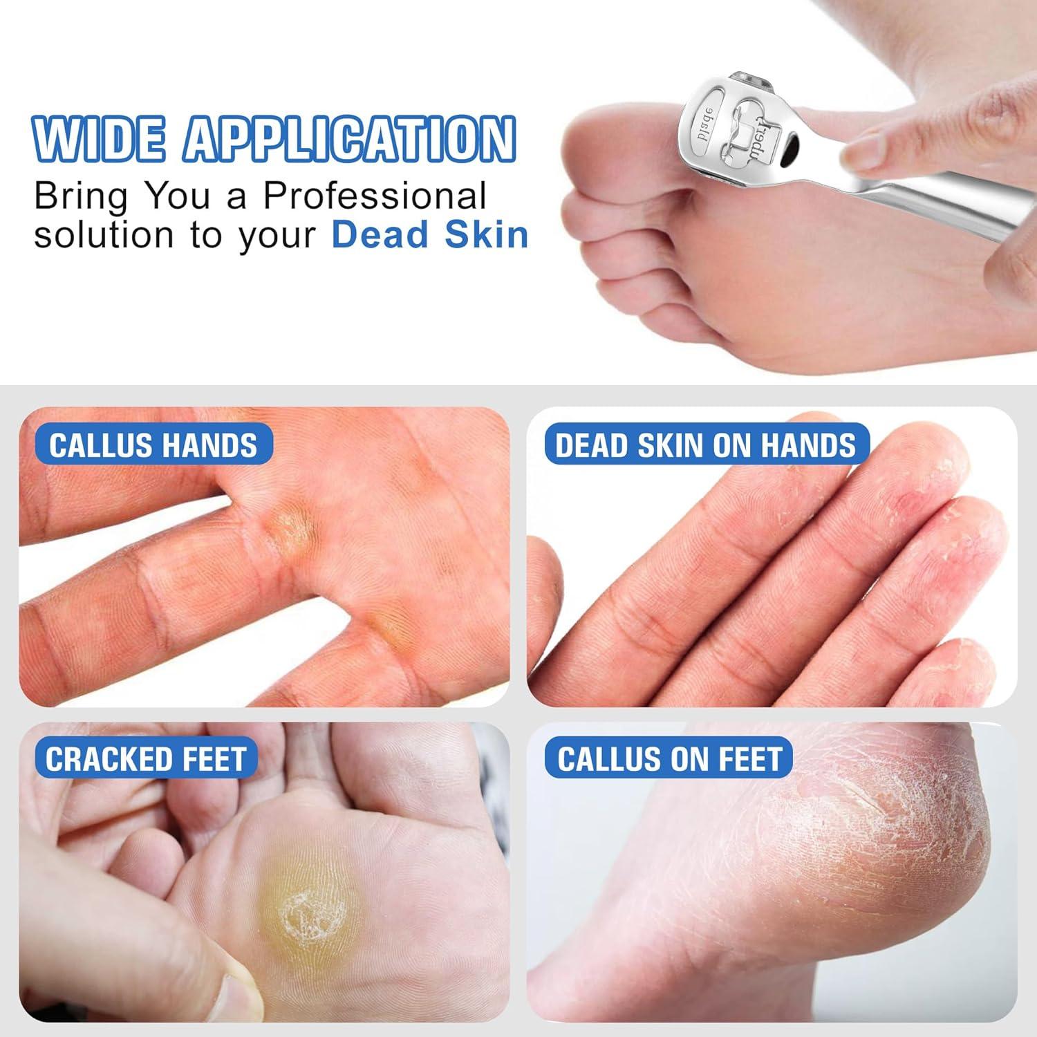 Kit de Raspador de Callos MIUKAA con 10 Cuchillas - Herramienta Profesional para Pies y Manos