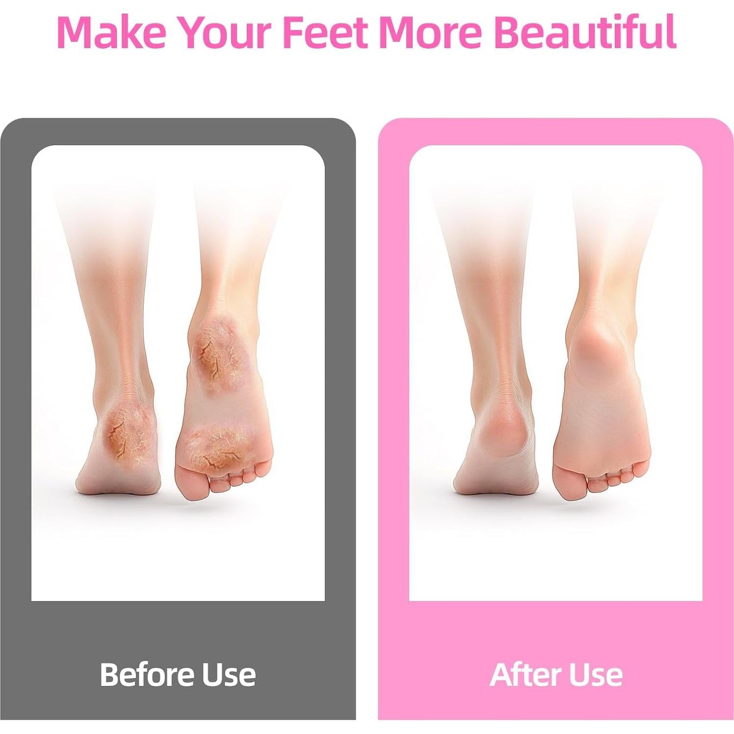 Removedor de Callos Eléctrico MARSDREAMS 802 Inalámbrico