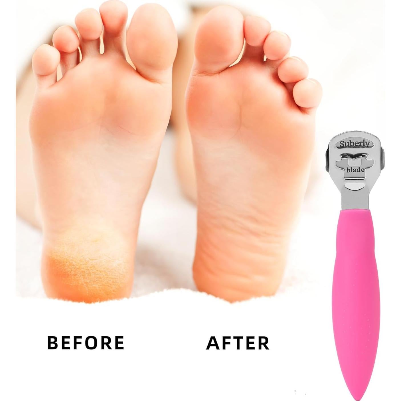 Removedor de Callos Dioche Acero Inoxidable Ergonómico Rosa