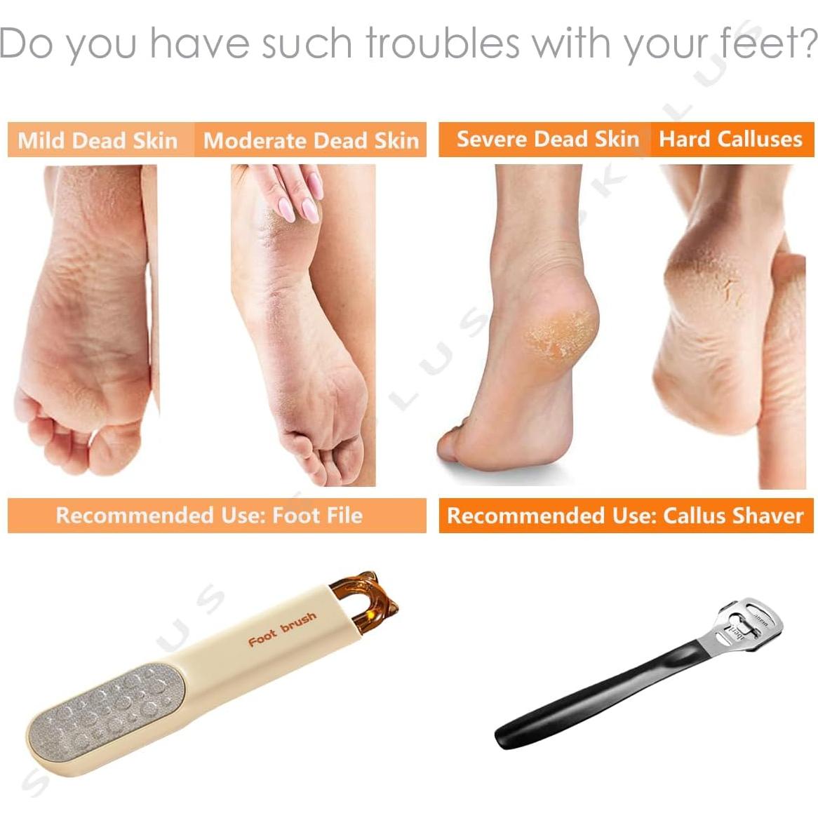 Lima para pies 2 en 1 TLS - Removedor de callos con 31 cuchillas