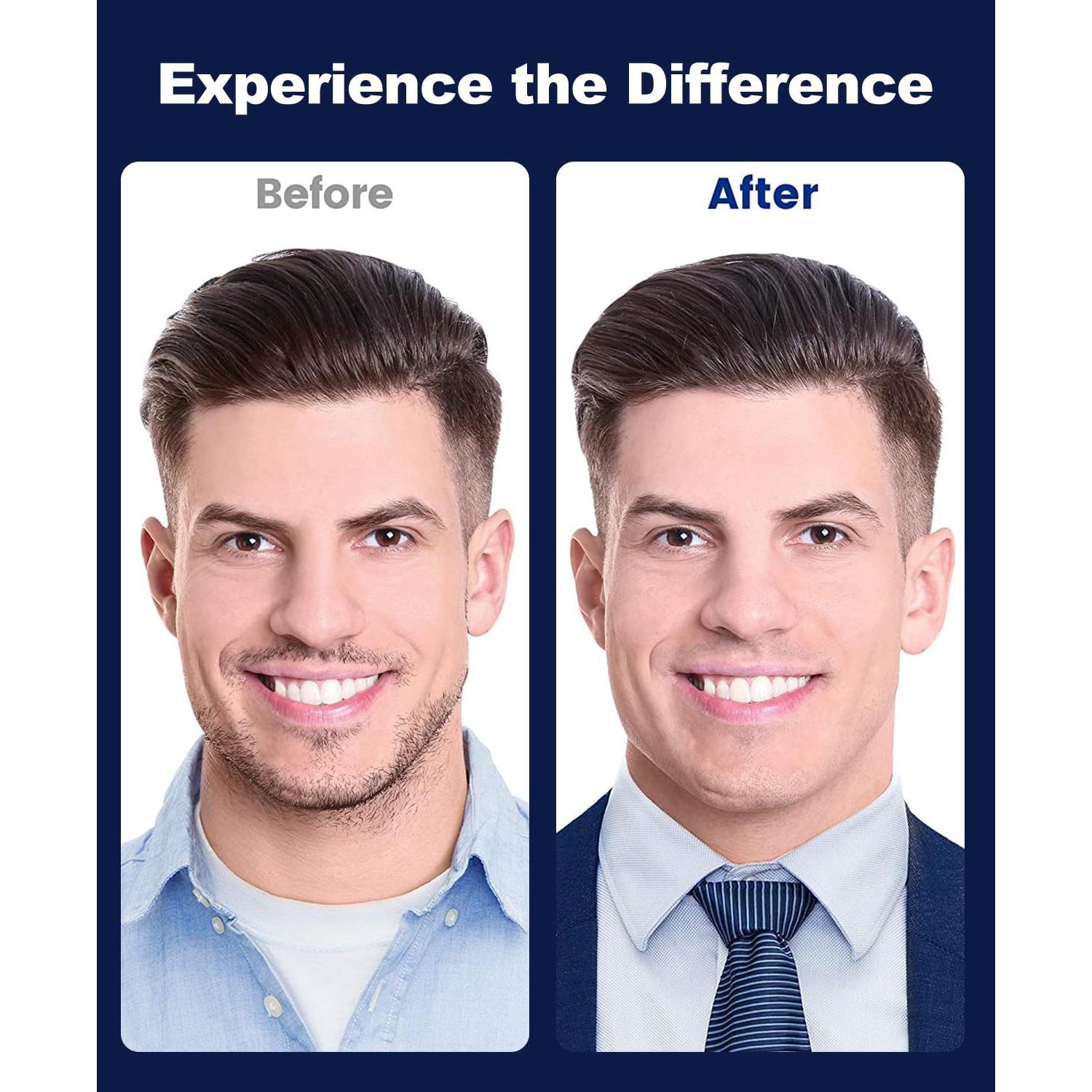 Inserciones de Cuello de Camisa Vivinin - 112 Piezas, 4 Tamaños