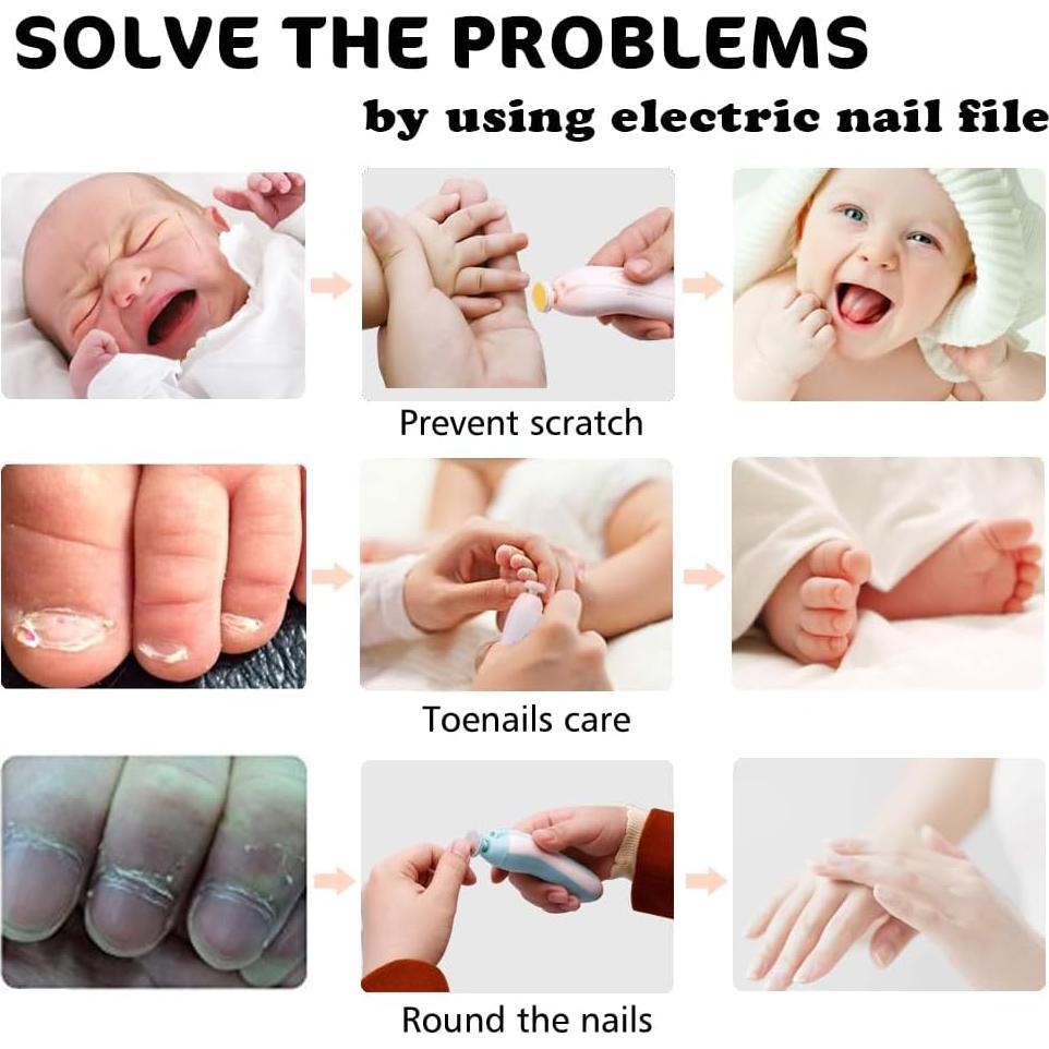 Cortador de Uñas Eléctrico Consevisen con Luz LED y 10 Accesorios