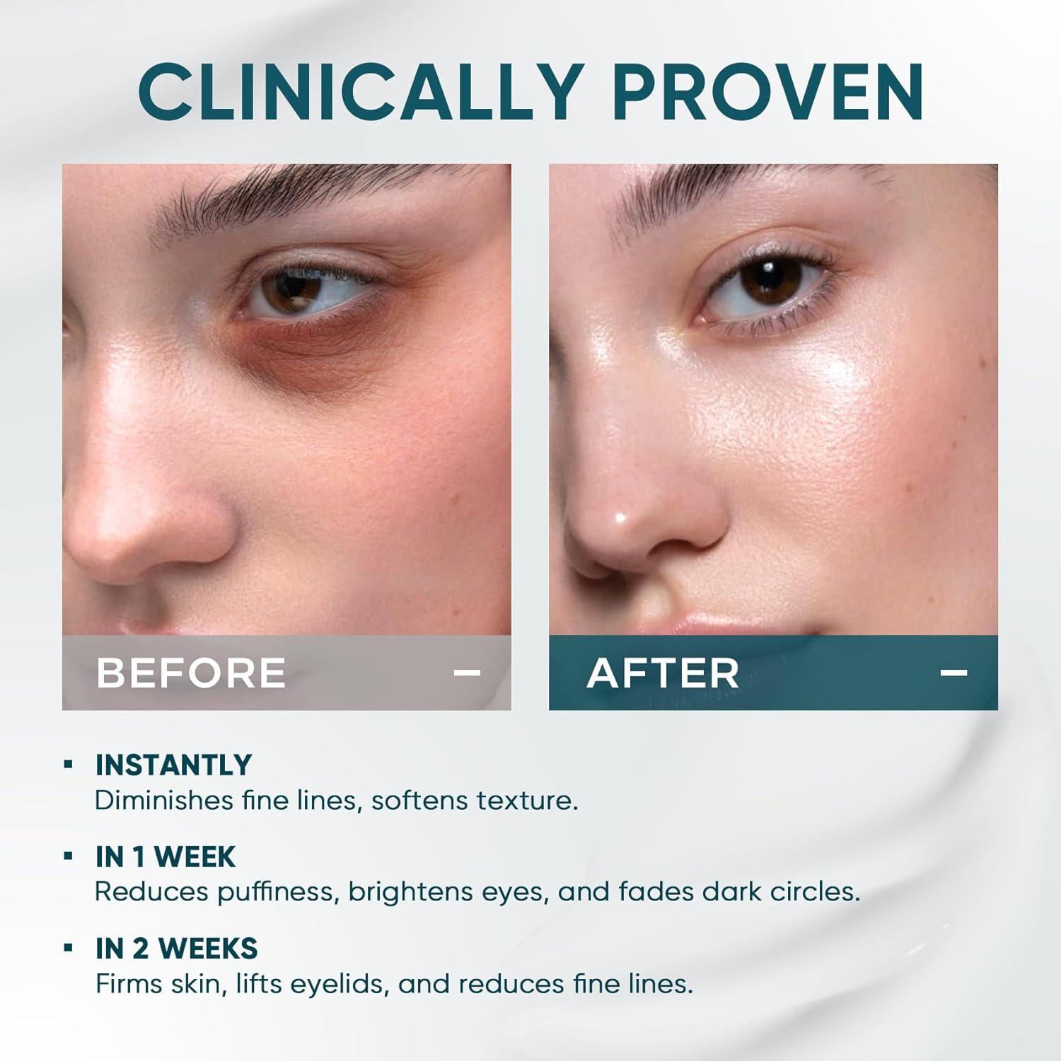 Elvira Dual Eye Cream for Dark Circles, Puffiness, Eye Bags, Wrinkles, Anti-Aging, Tightening, and Moisturizing with Advanced Retinol, Five-Peptide Complex, and Stem Cell Extracts – 0.68 OZ