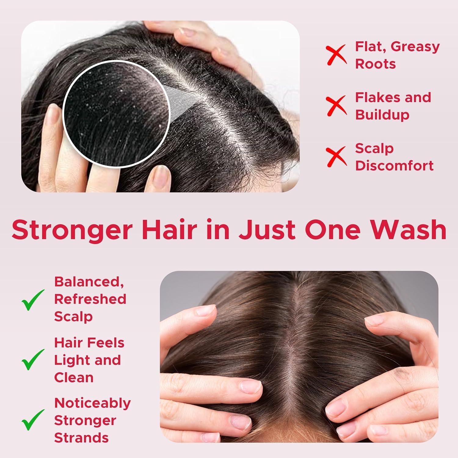 Champú Aclarador Nora Ross 946 ml - Control de Aceite y Fortalecedor