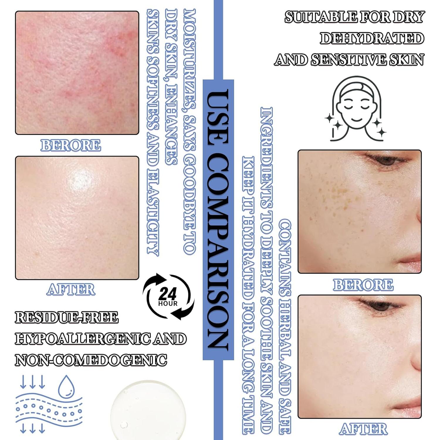 Conjunto de 22 Mascarillas Faciales Hidratantes LZYLLS