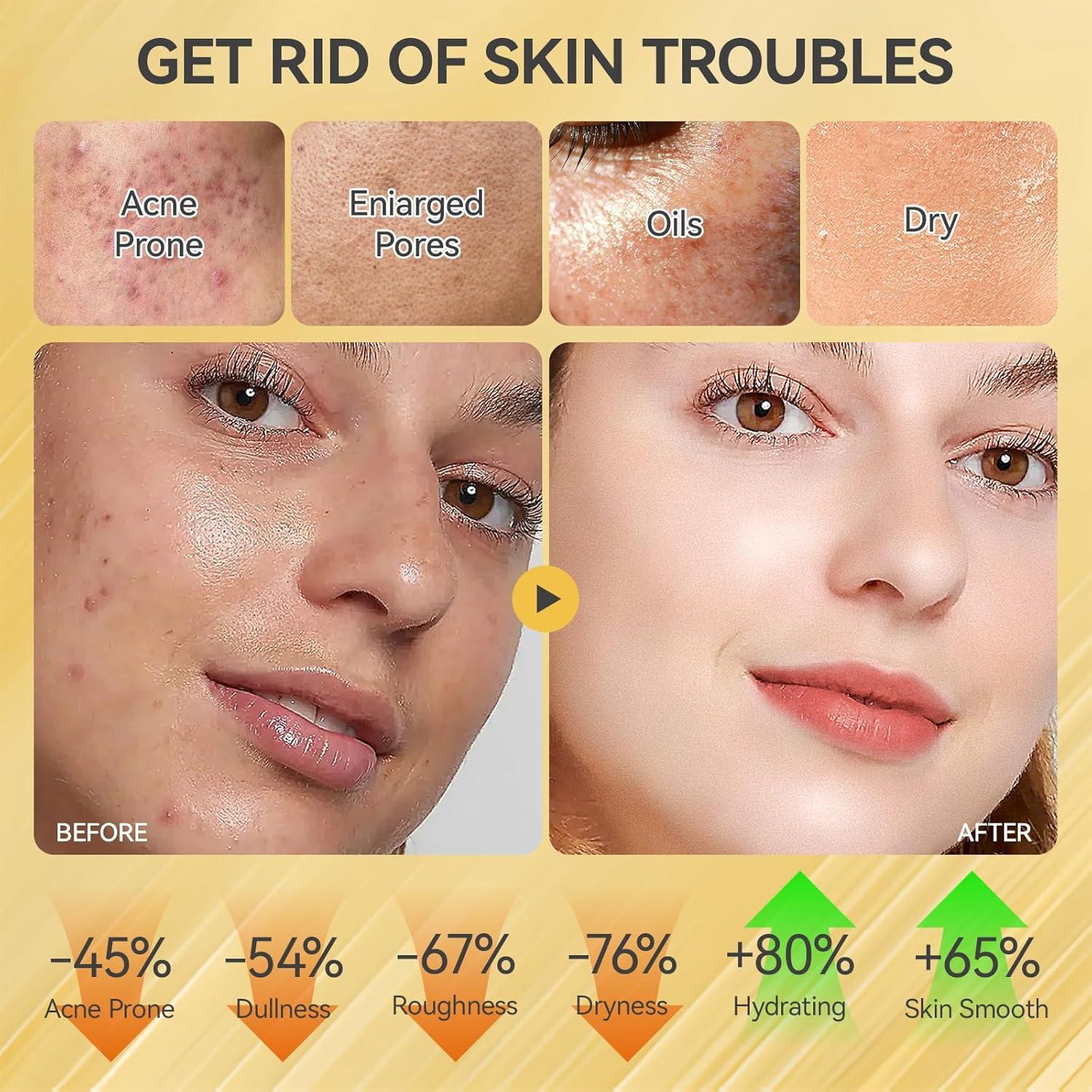 Conjunto de Cuidado de la Piel Onkessy 5 Piezas Hidratante