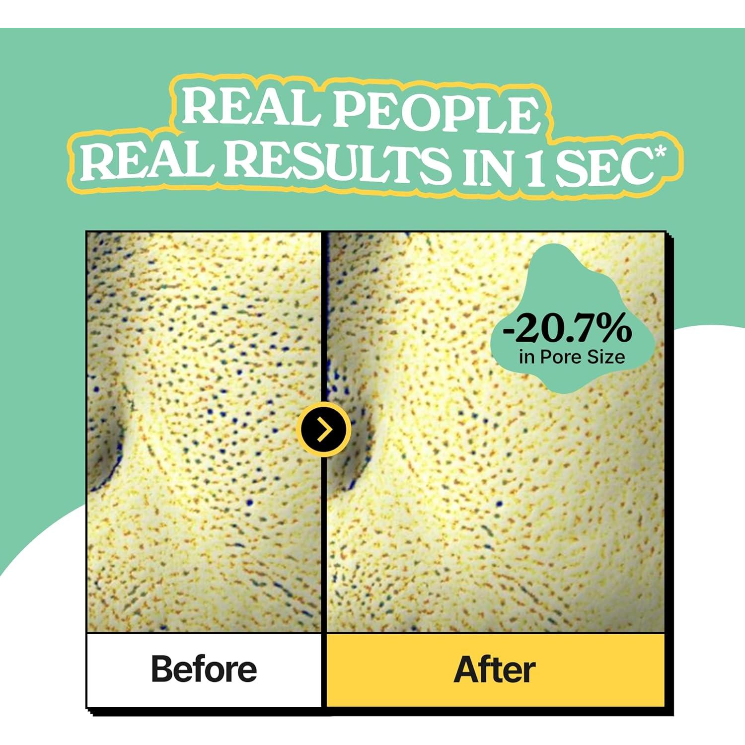 Suero Facial Vividraw Vinagre de Manzana 40ml - Cierre de Poros