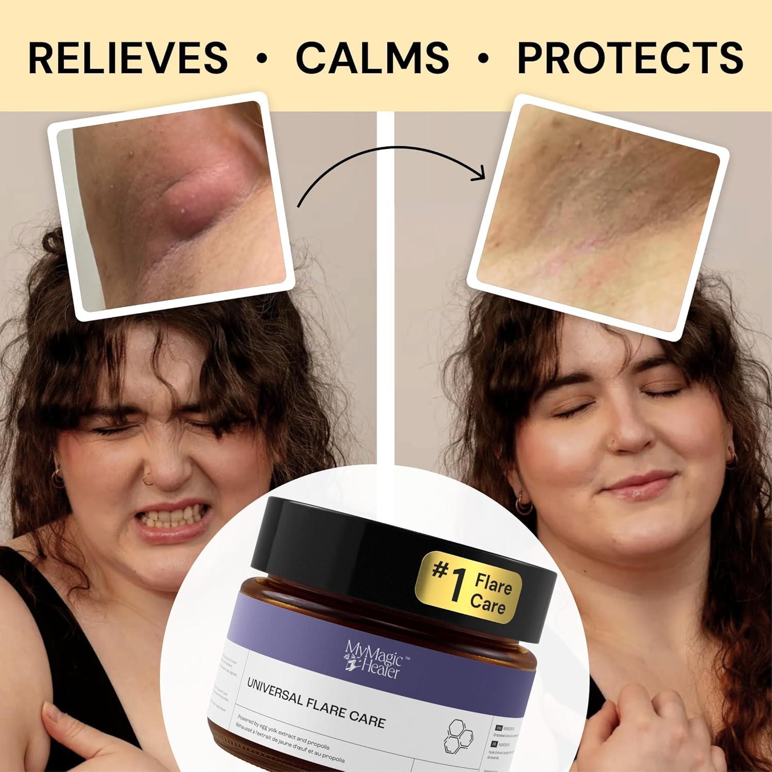 Cuidado de Piel MyMagicHealer 28.35 g - Alivio Natural Brotes