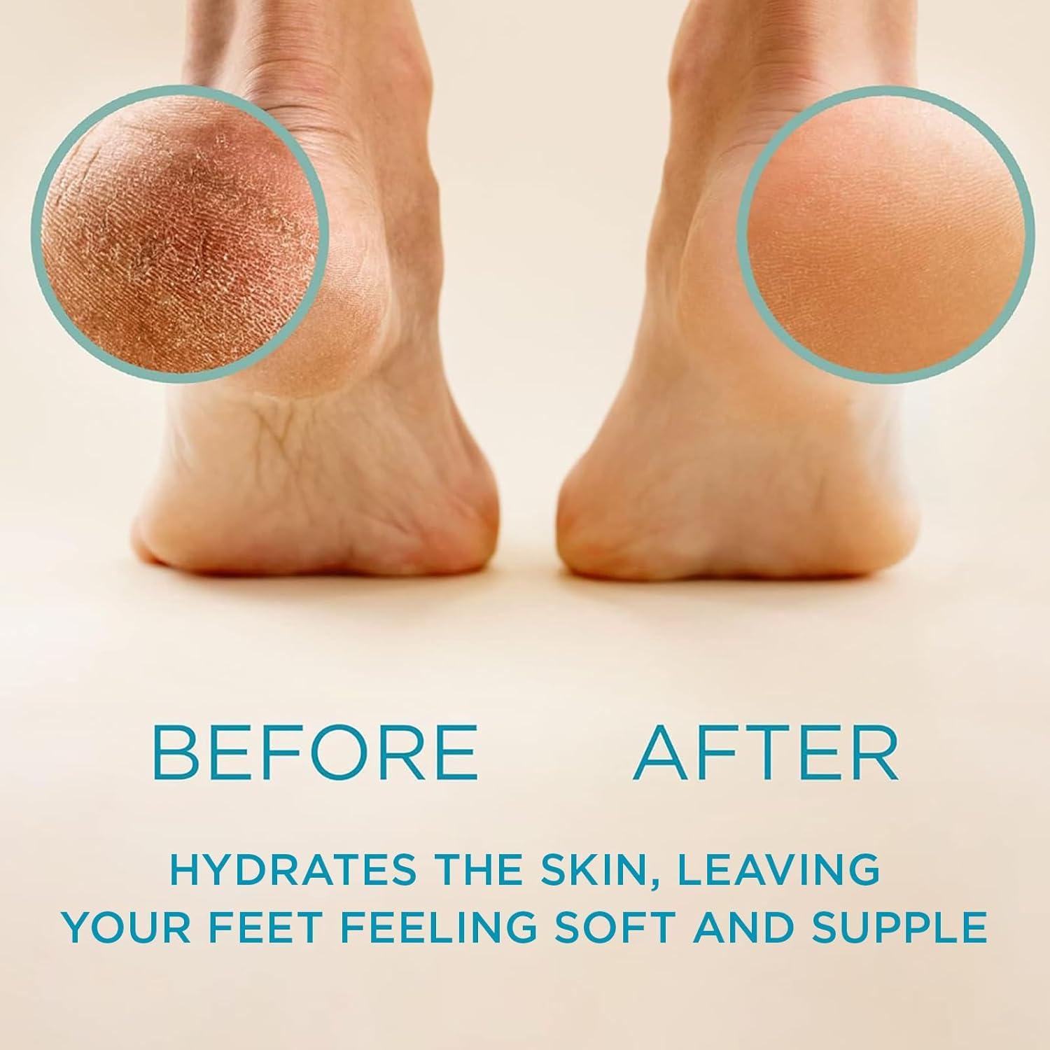 Kit Removedor de Callos Lee Beauty - Gel y Lima para Pies 226.8 g