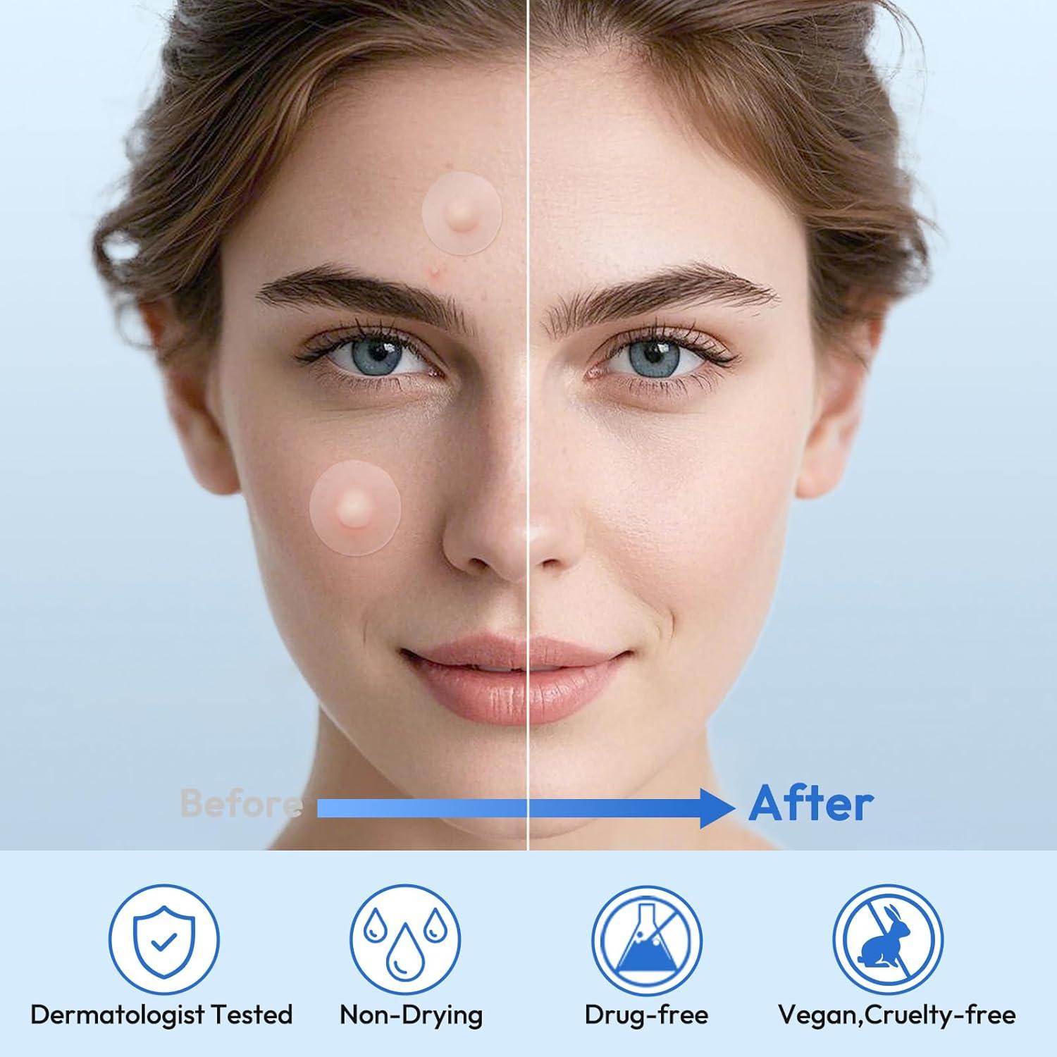 Parche Hidrocoloide para Espinillas Breiboz - 331 Parches