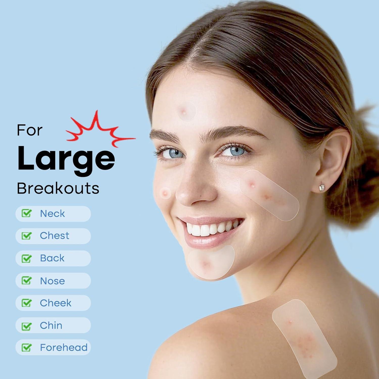 Parche Hidrocoloide para Espinillas Breiboz - 331 Parches