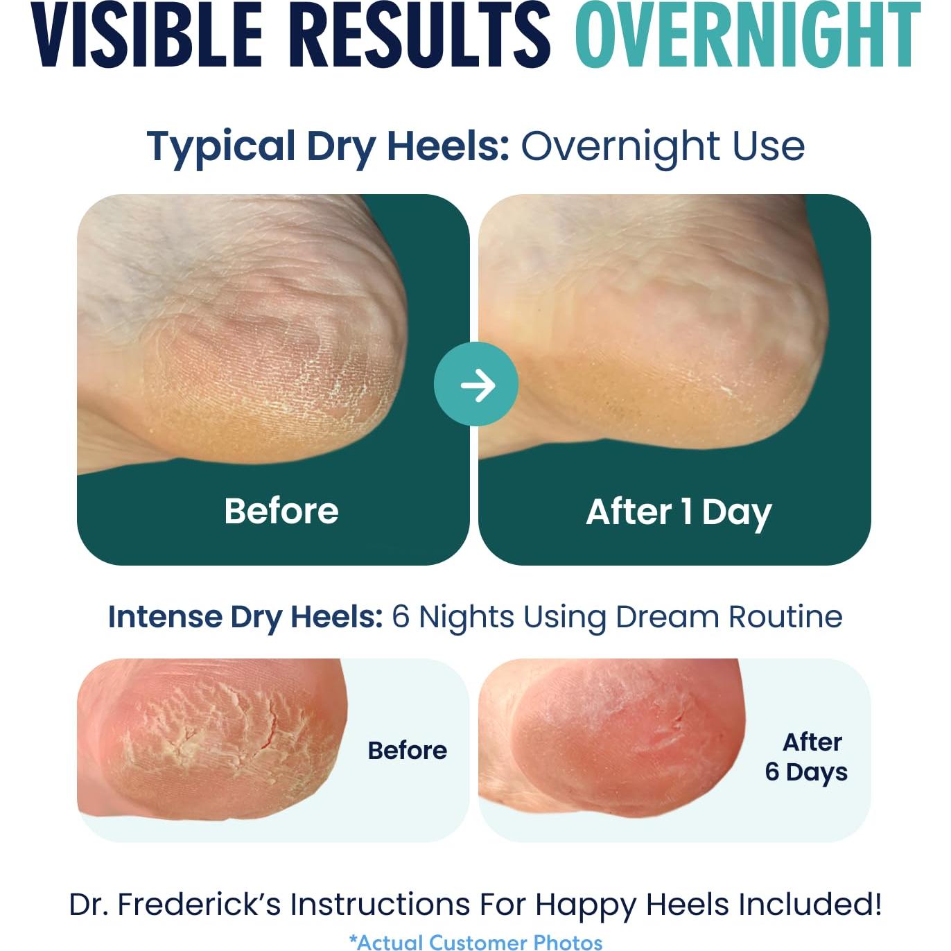 Calcetines Hidratantes Dr. Frederick para Talones Agrietados - 2 Pares - Aloe y Oliva