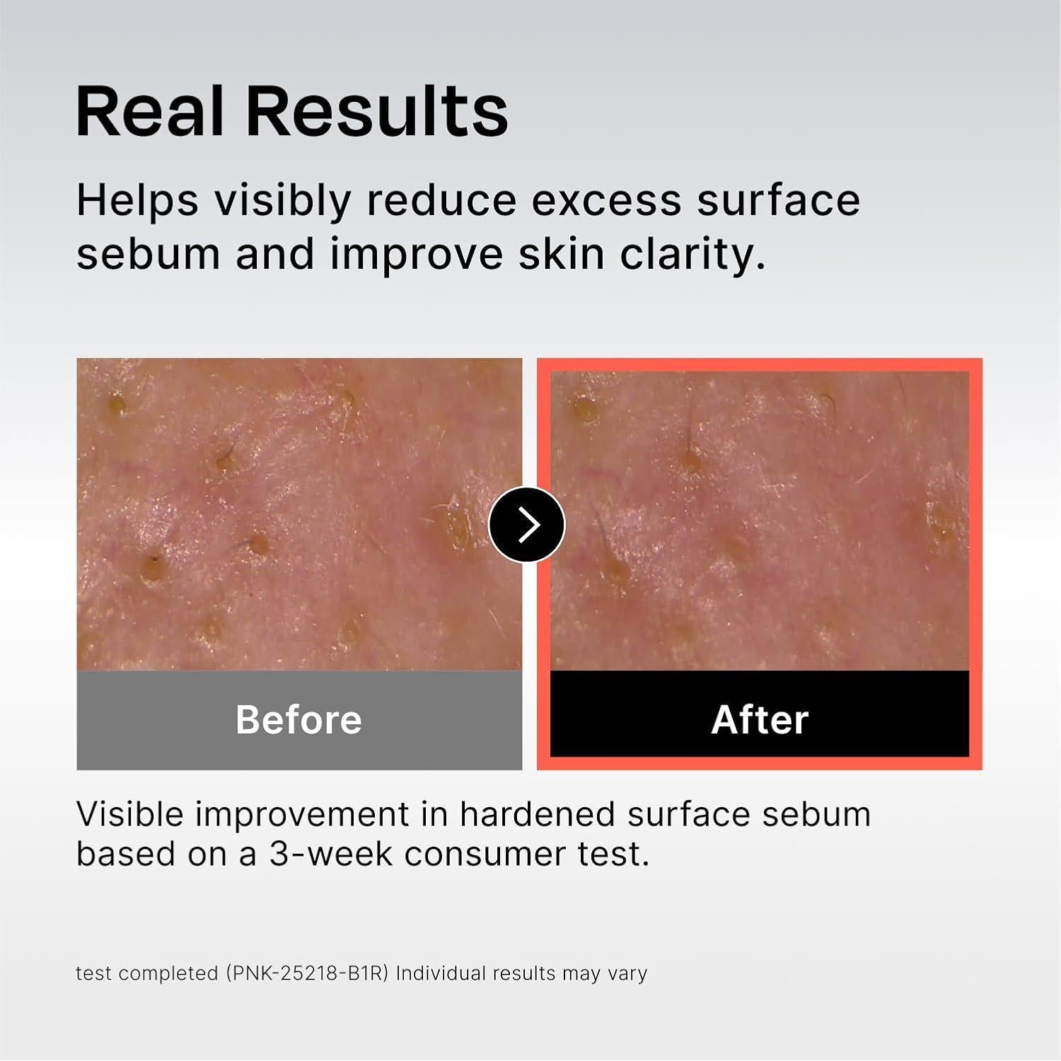 Suero Desobstruyente de Poros Celladix 131 - 30 ml