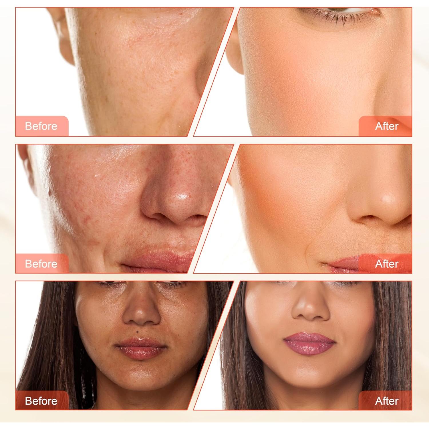 Máquina de Microdermoabrasión de Diamante Elitzia ETNF108 3 en 1