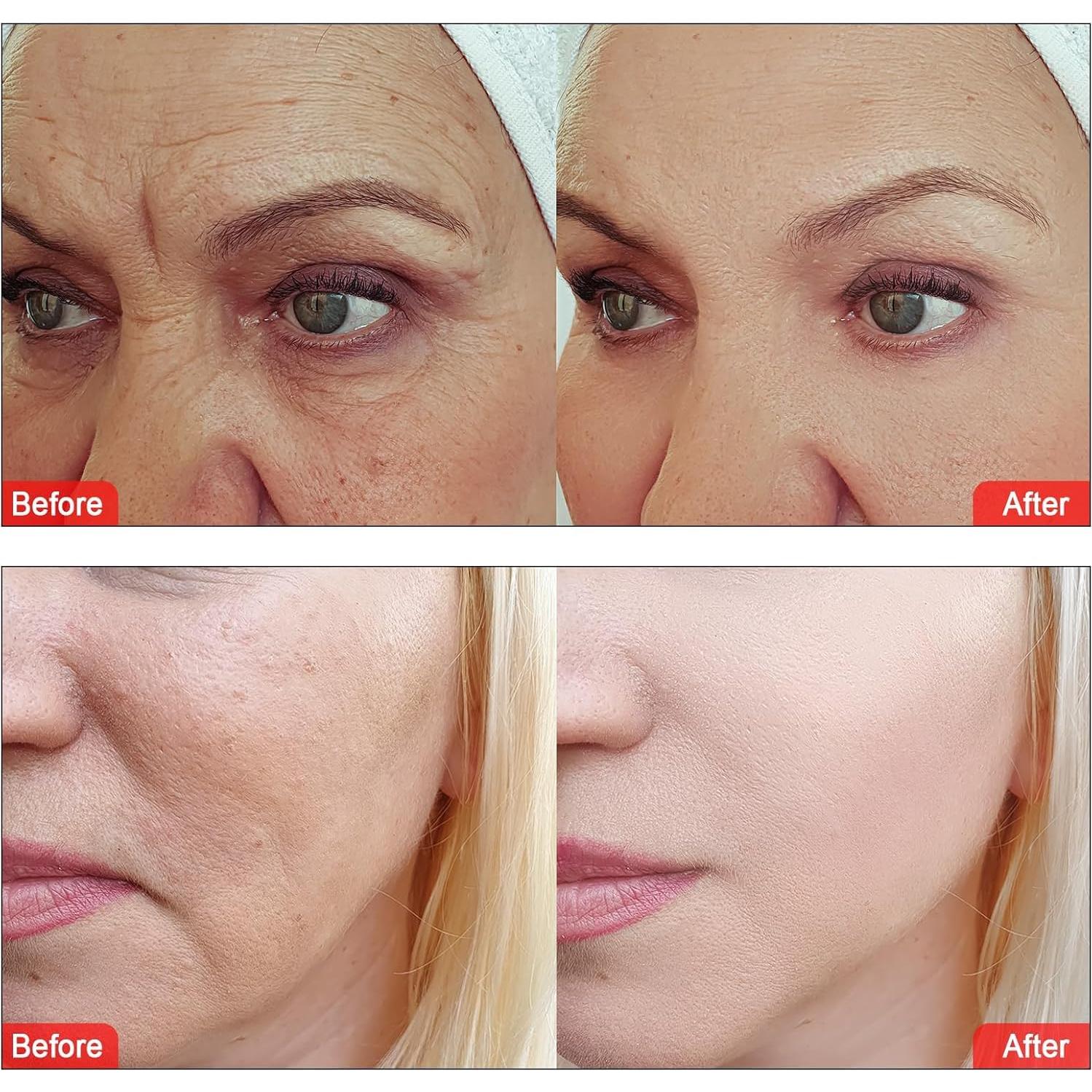 Set de 3 Soluciones Hidratantes Elitzia 400ml para Piel