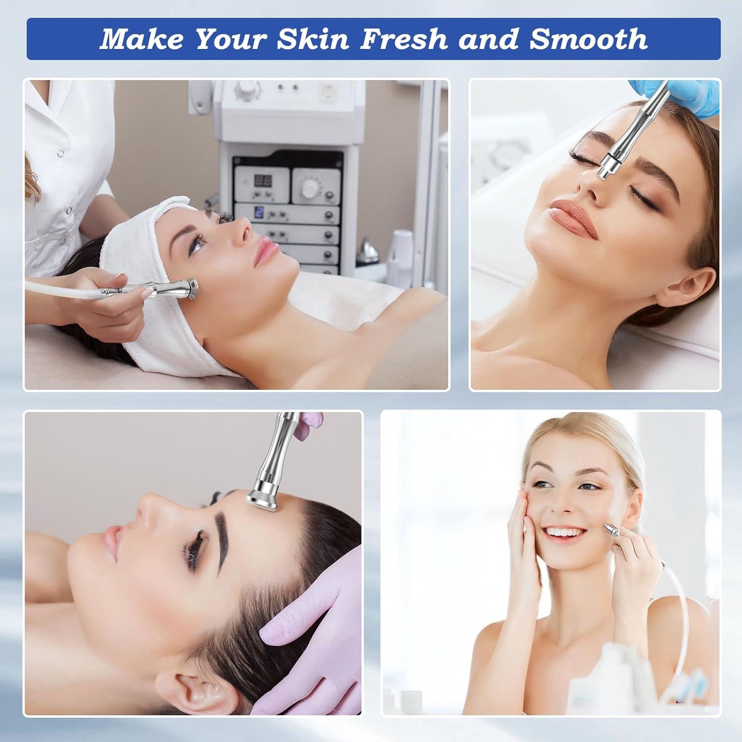 Consejos de Microdermoabrasión Yekavo - 9 Piezas + 3 Varitas