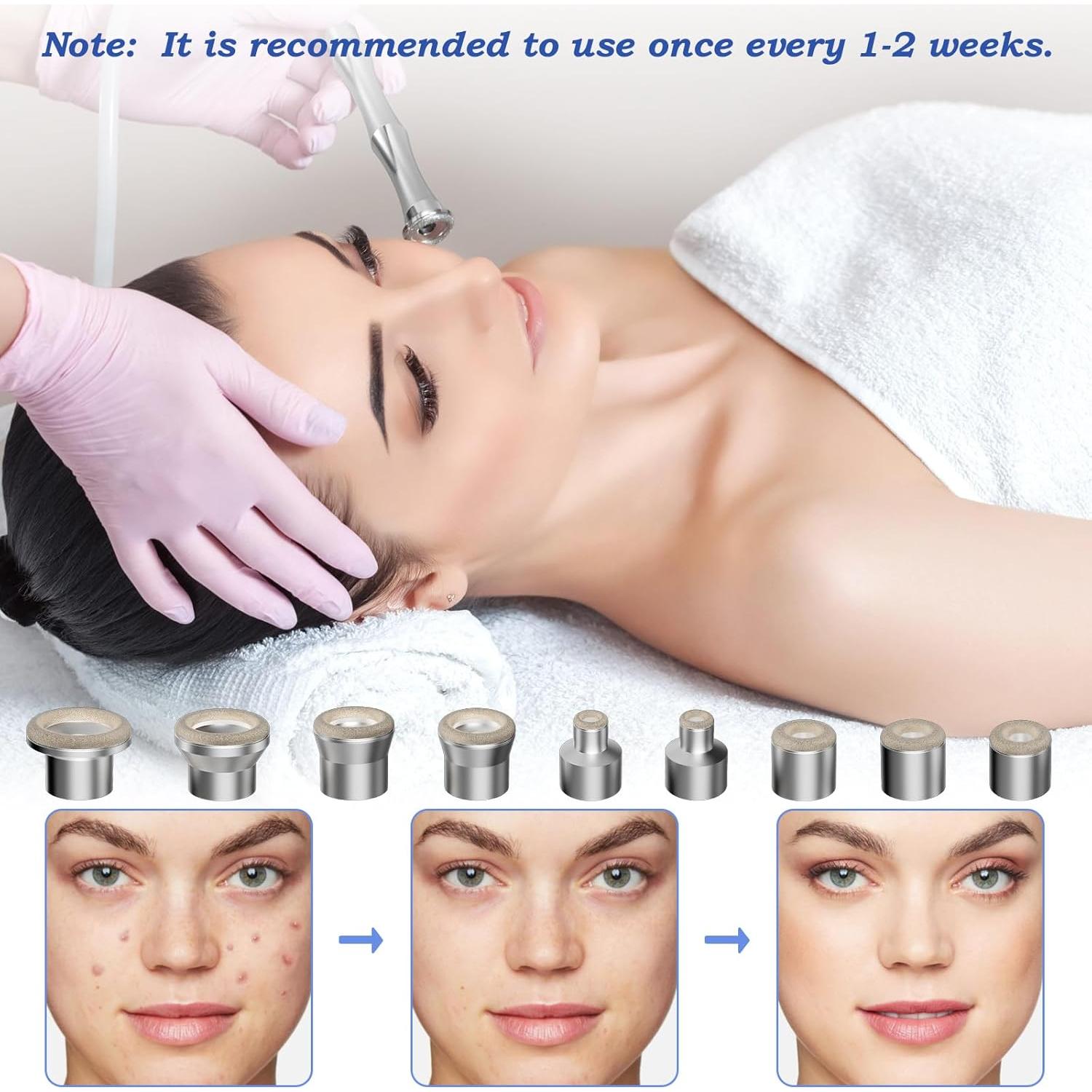 Consejos de Microdermoabrasión Yekavo - 9 Piezas + 3 Varitas