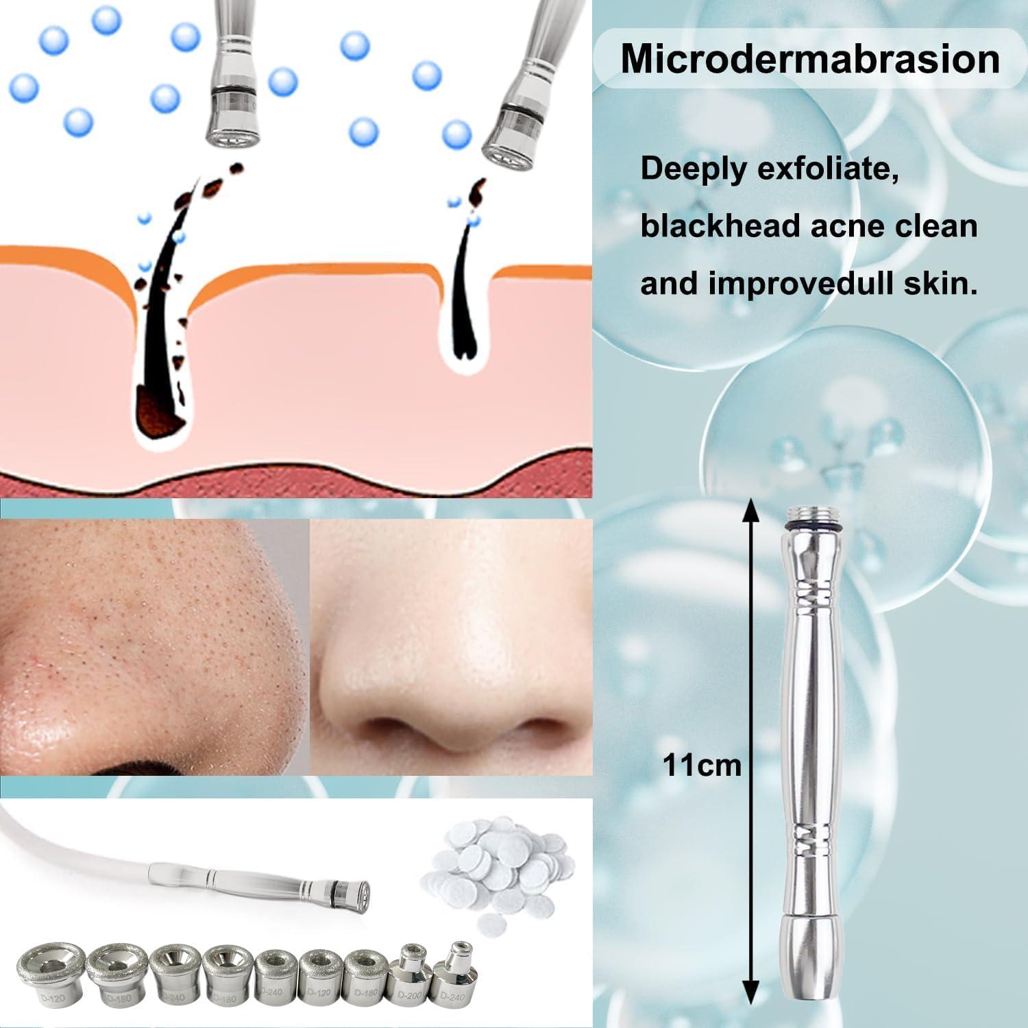 Kit de Microdermoabrasión ZEIZOMZER con 9 Consejos y Filtros