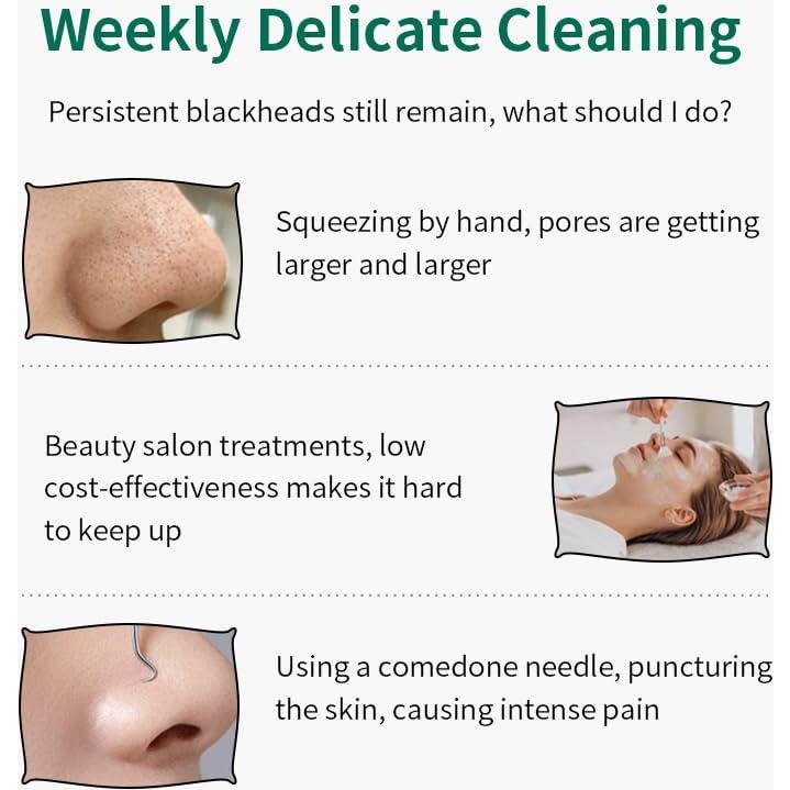 Removedor de Puntos Negros Baotuiok JG01 Espátula Facial Roja