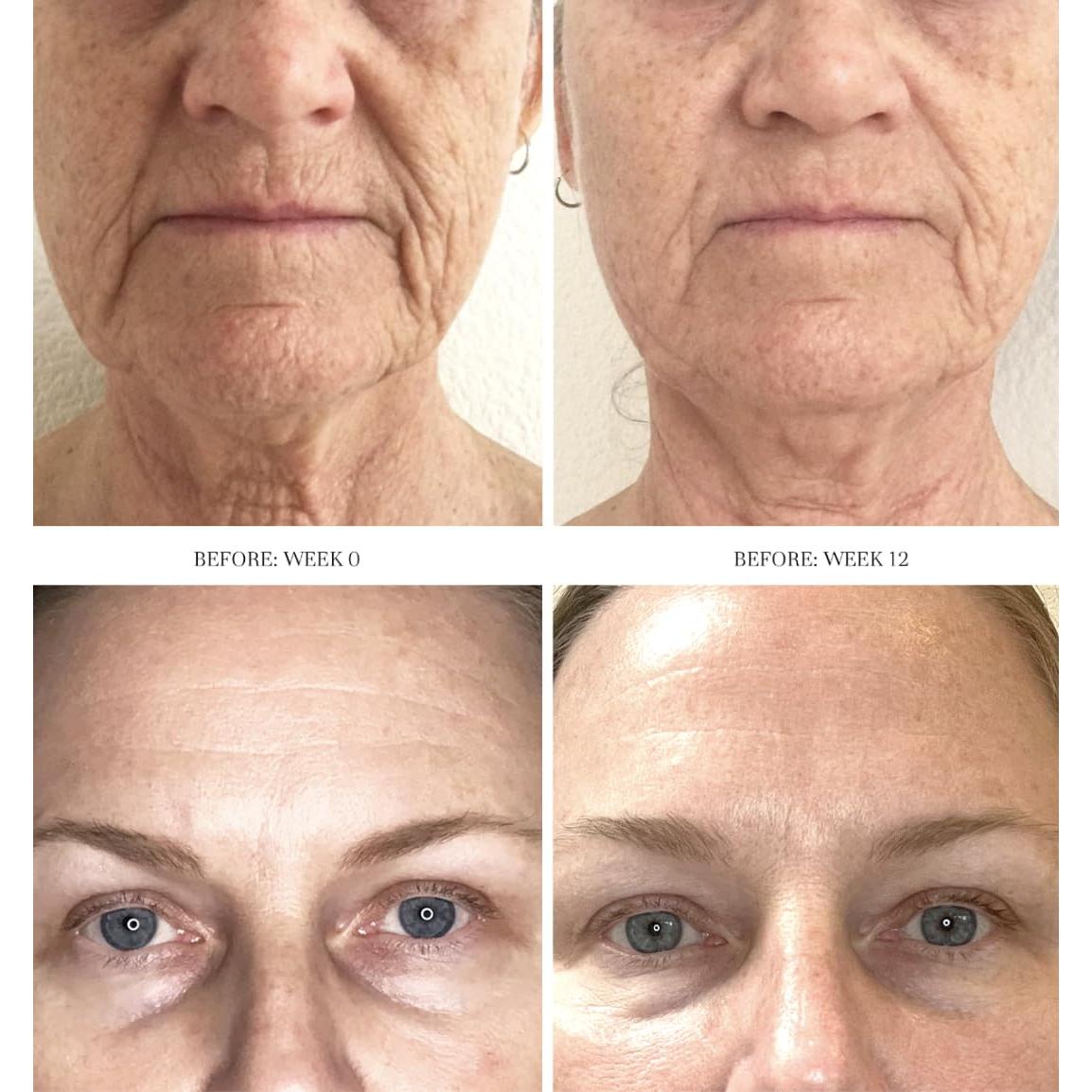 Exfoliante Facial Diario City Beauty Dermal Reset AHA 68g