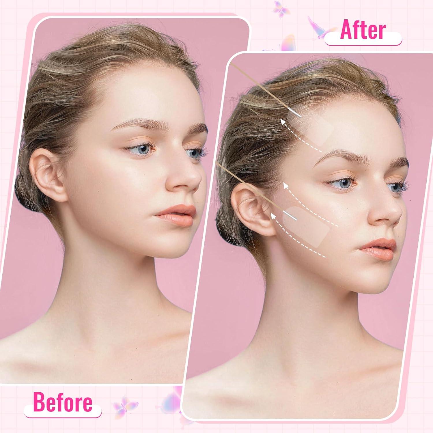 Cinta Levantadora Facial Invisible NATOPUT - 120 Piezas