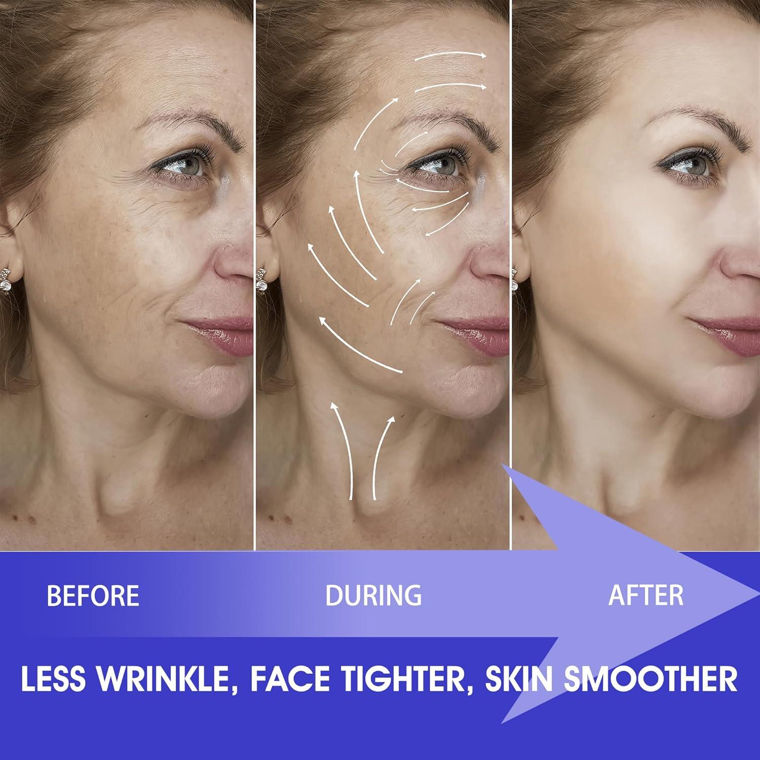 Parche Antienvejecimiento Titaya 160 PCS Cinta Facial Suave