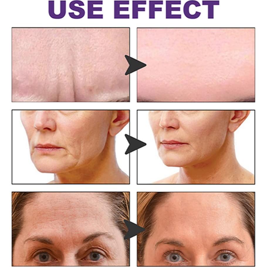 Parches Antiarrugas Faciales 100 Piezas Cinta Invisible